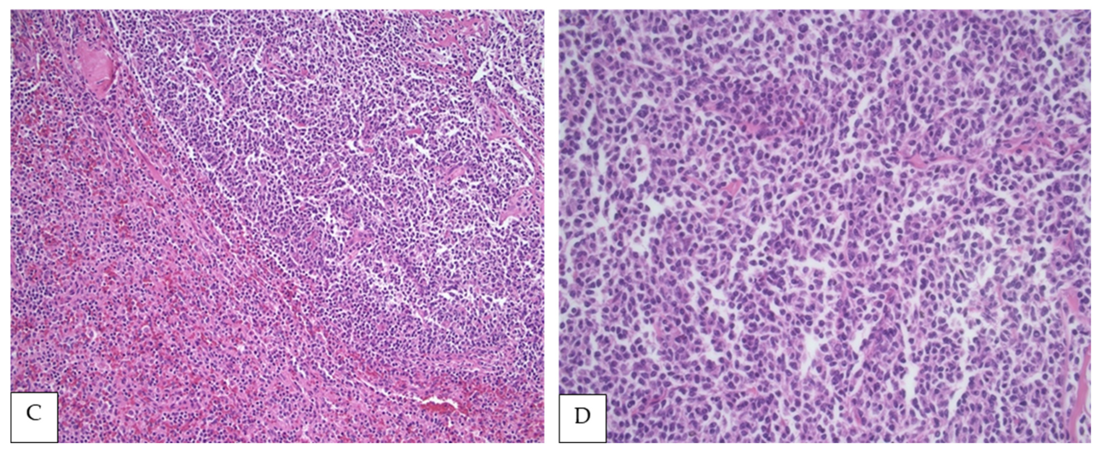 Curroncol 28 00407 g001b Curroncol 28 00407 g001b