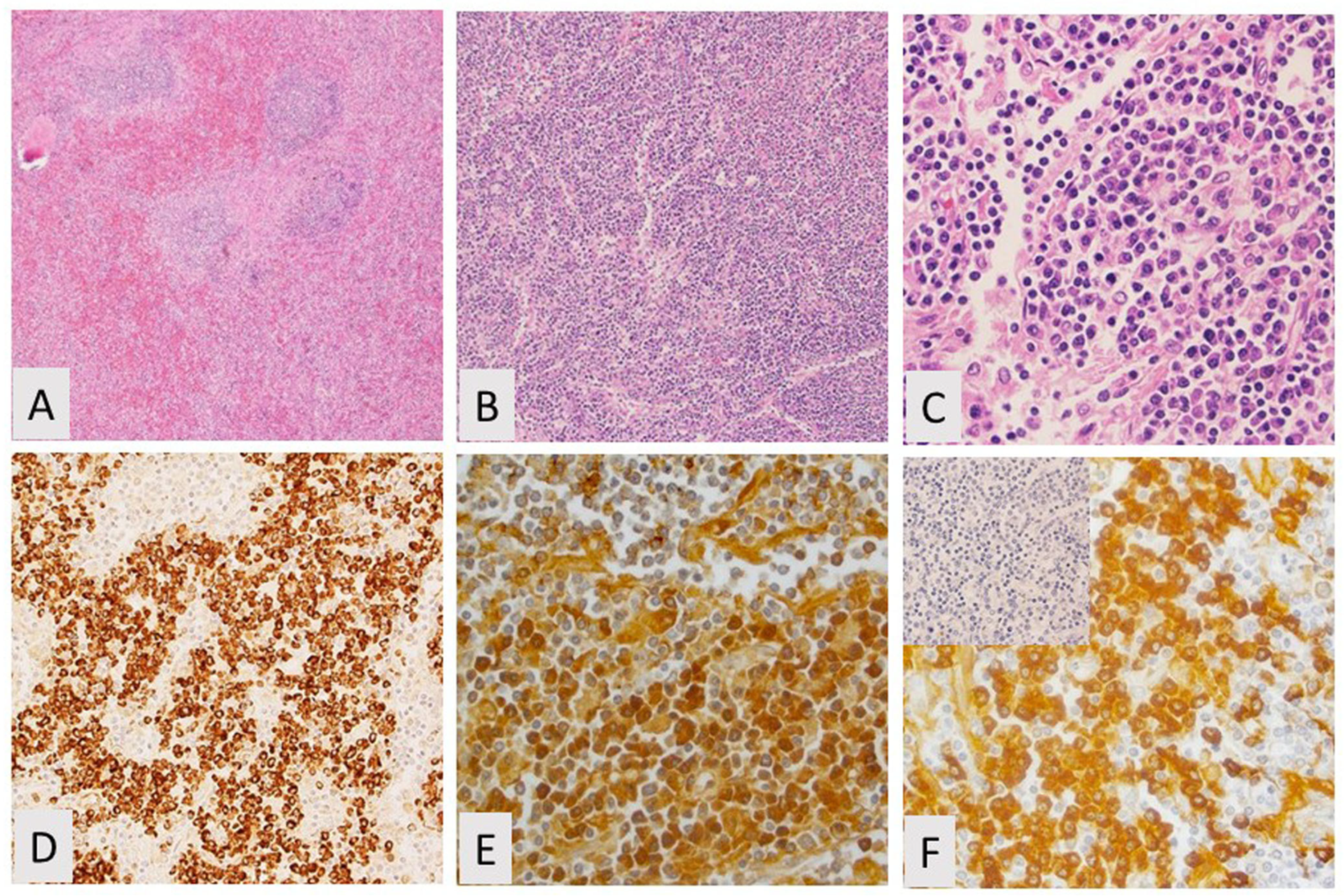 Curroncol 28 00430 g006