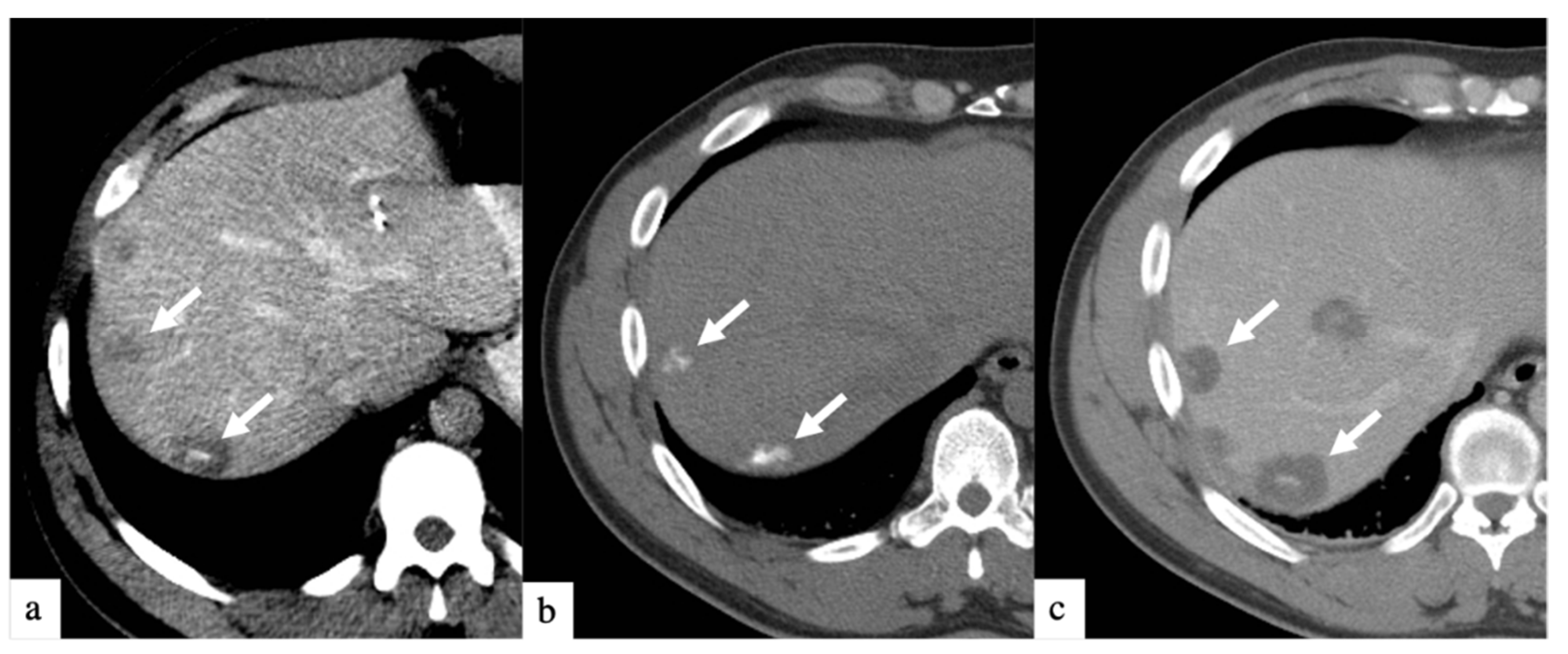 Curroncol 29 00020 g002 Curroncol 29 00020 g002