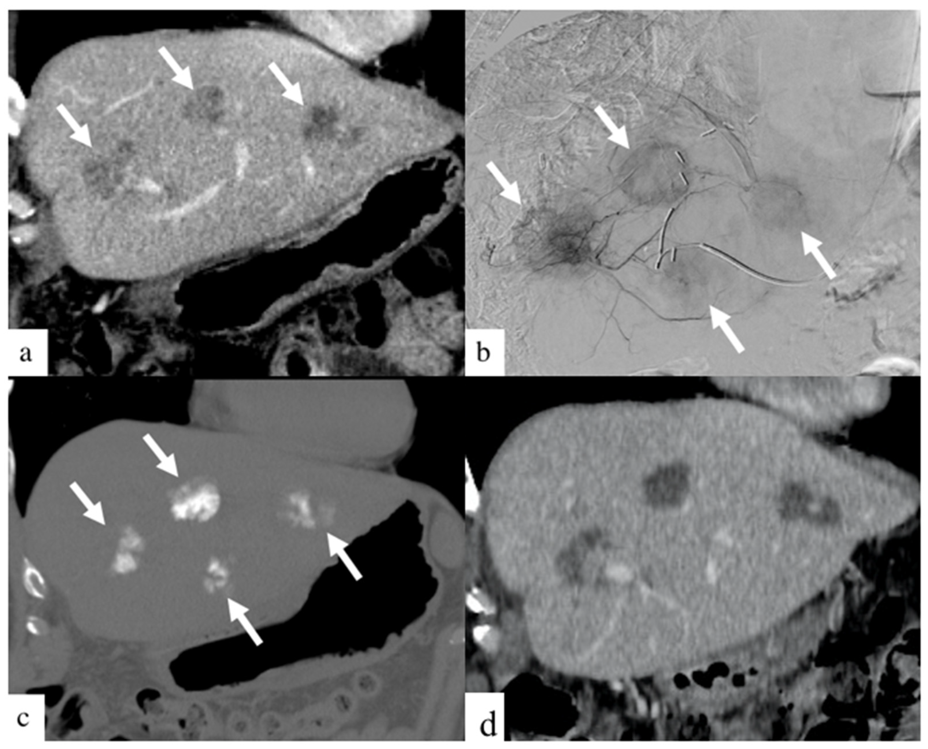 Curroncol 29 00020 g003 Curroncol 29 00020 g003