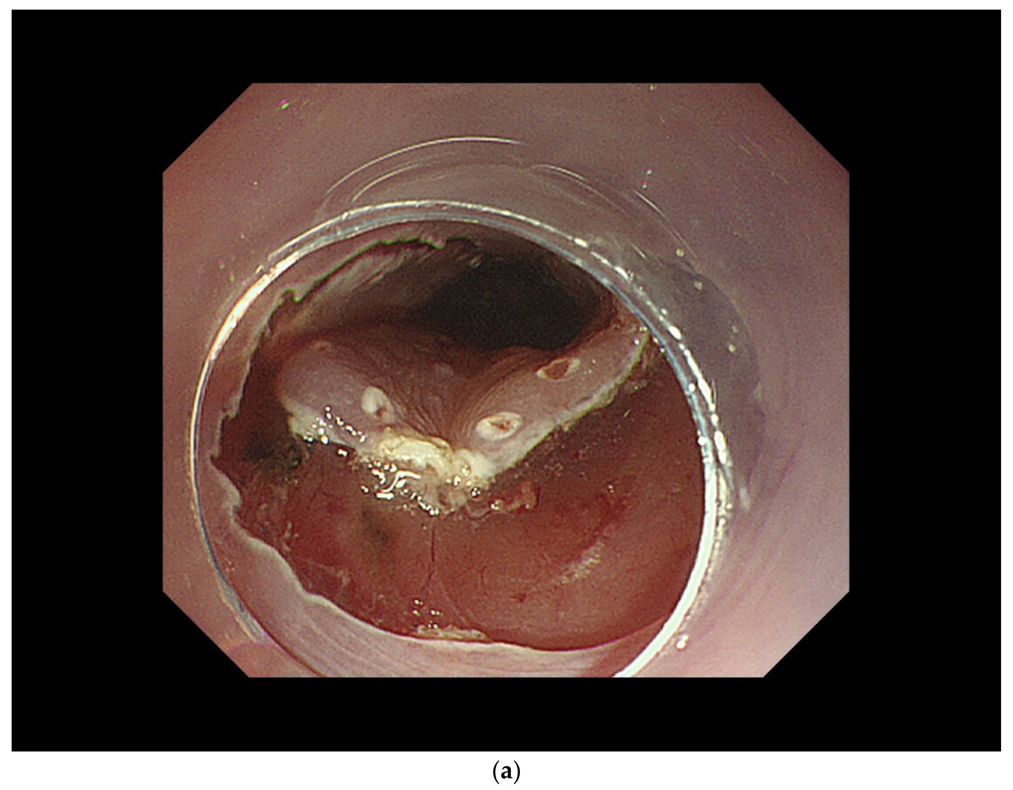 Curroncol 29 00048 g003a