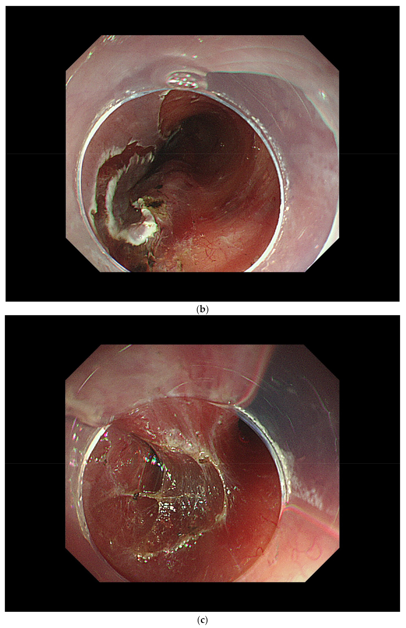 Curroncol 29 00048 g003b