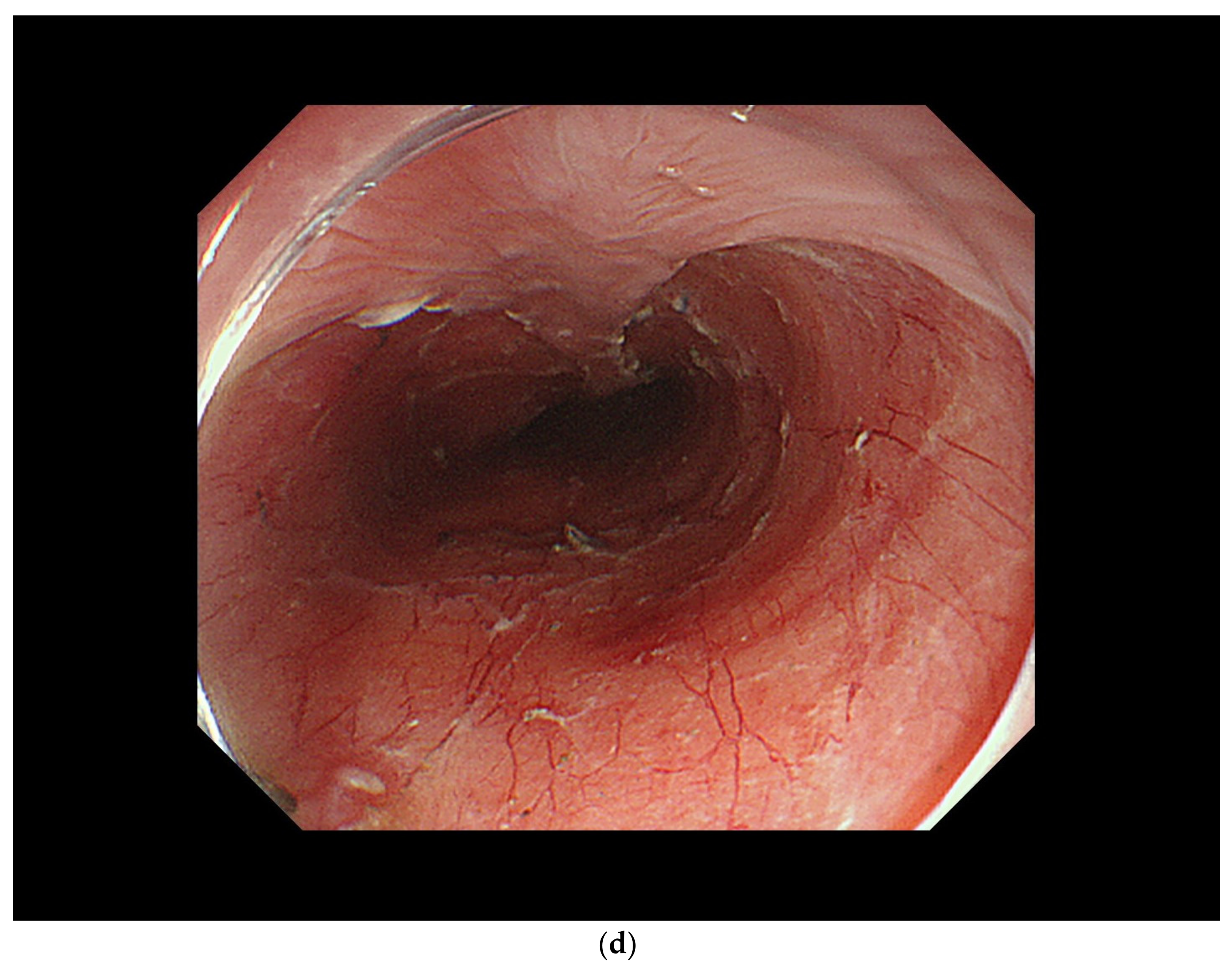 Curroncol 29 00048 g003c