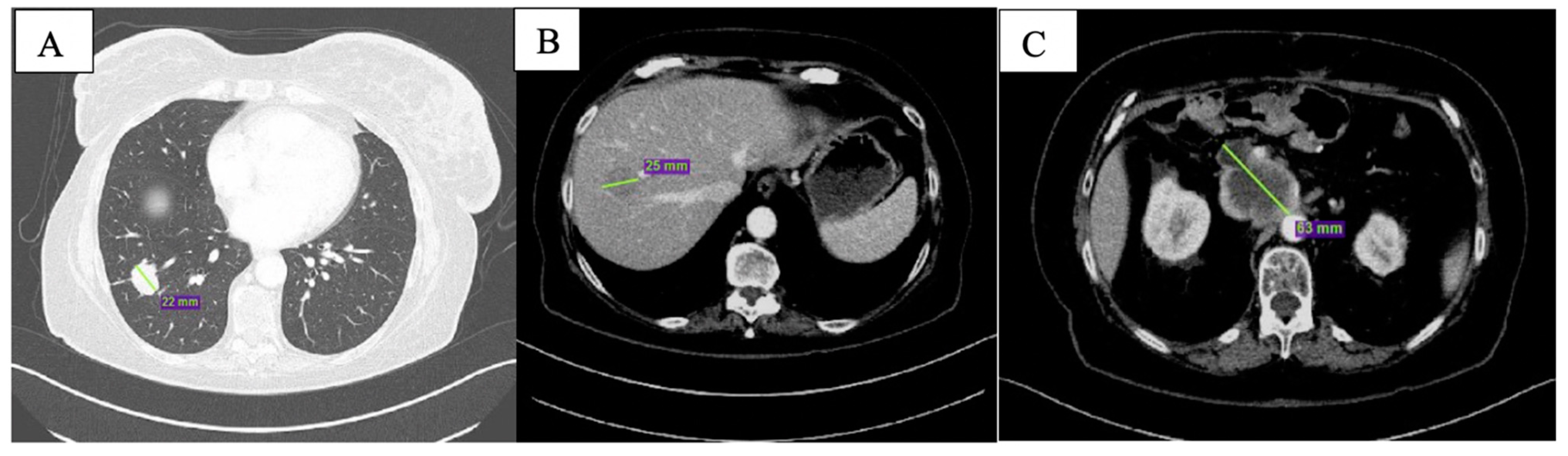 Curroncol 29 00049 g001