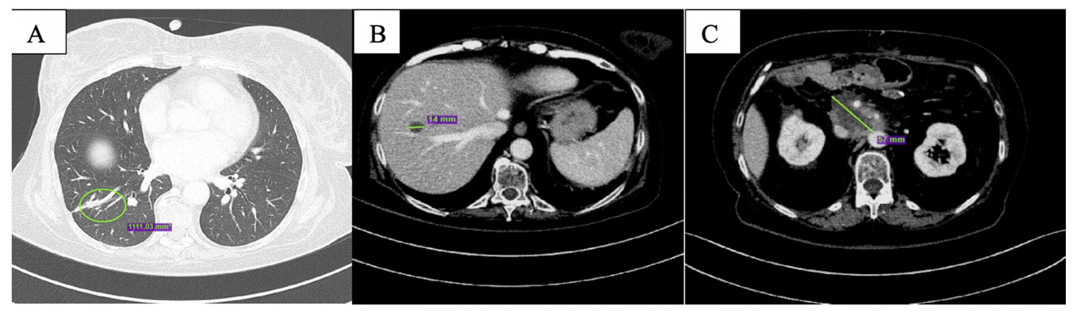 Curroncol 29 00049 g002