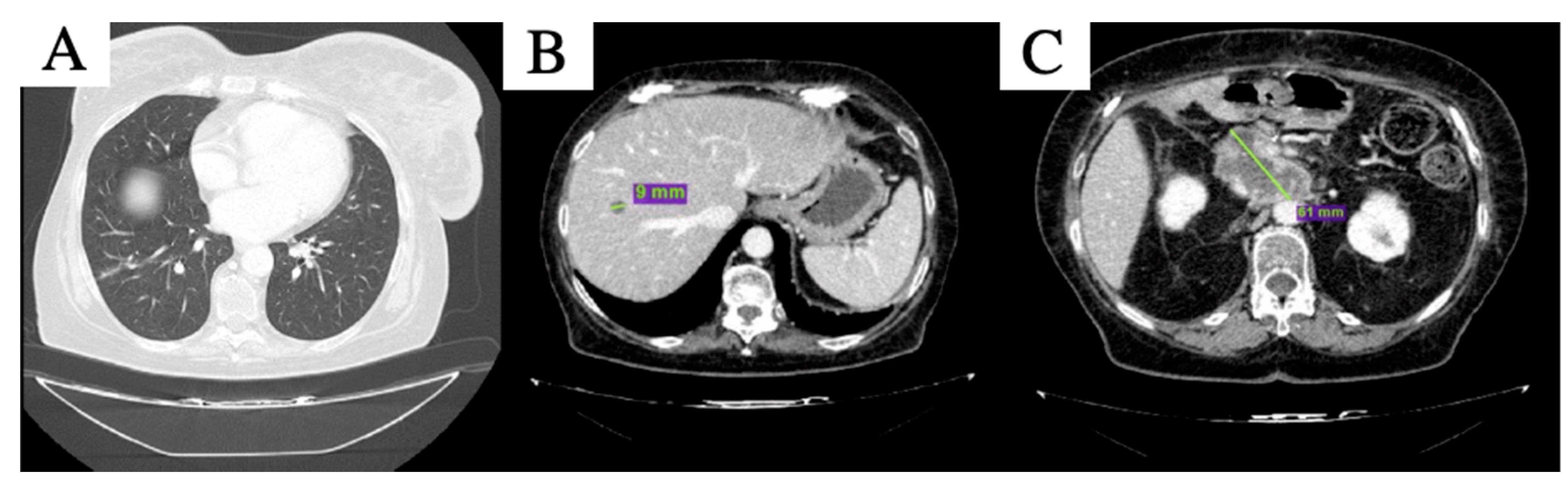 Curroncol 29 00049 g003
