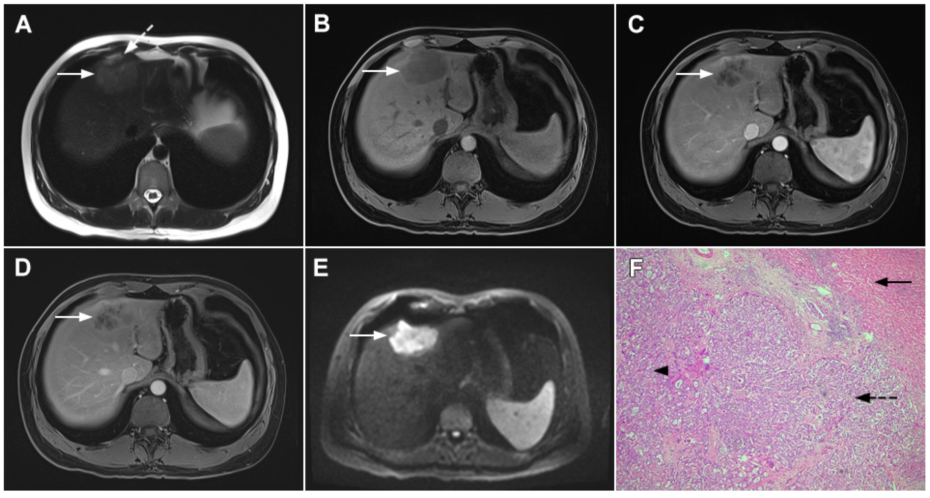 Curroncol 29 00061 g005 Curroncol 29 00061 g005