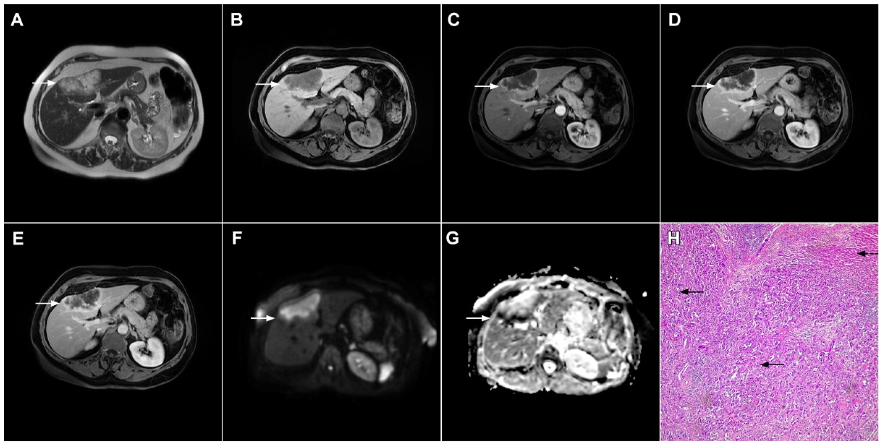 Curroncol 29 00061 g007 Curroncol 29 00061 g007