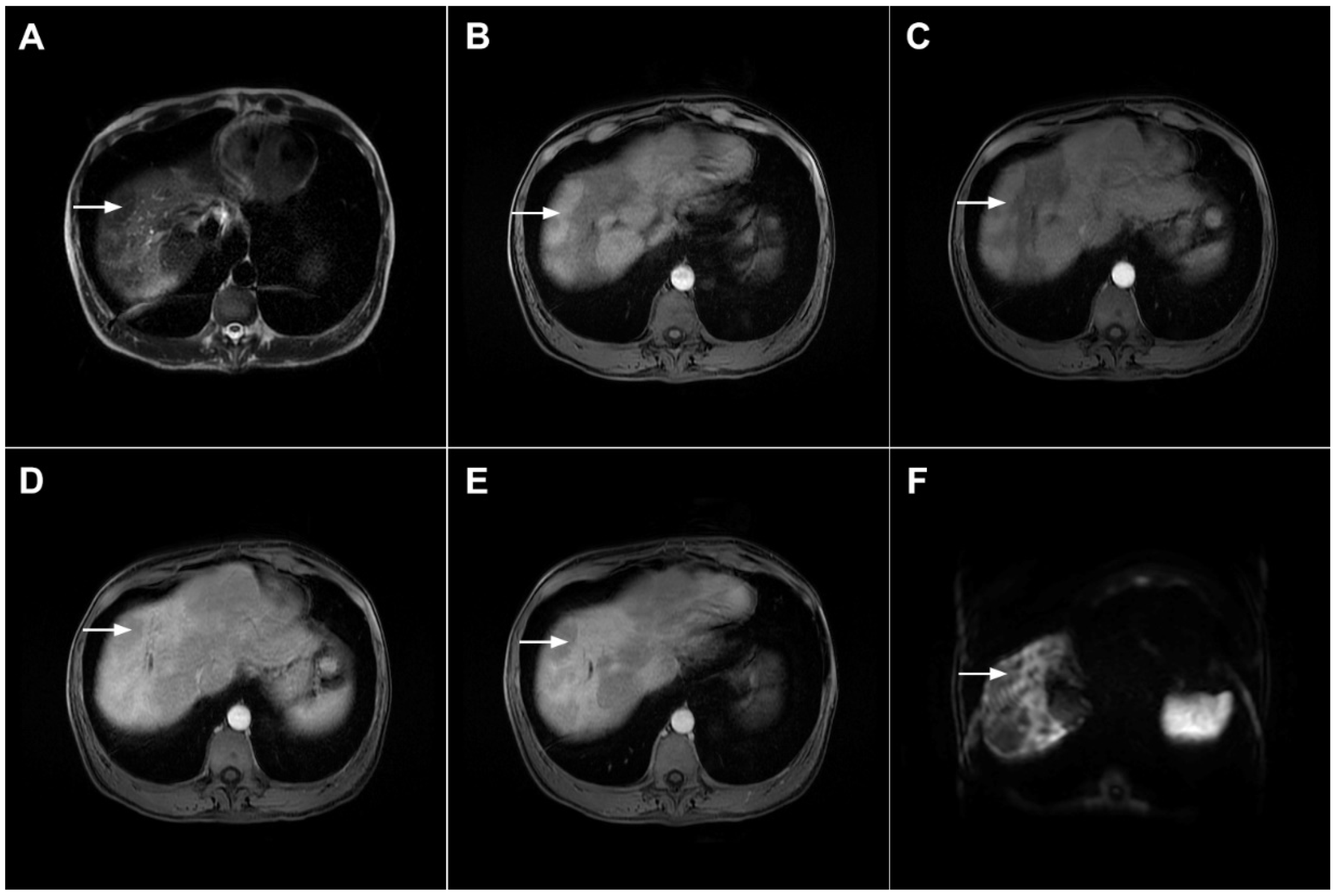 Curroncol 29 00061 g008 Curroncol 29 00061 g008