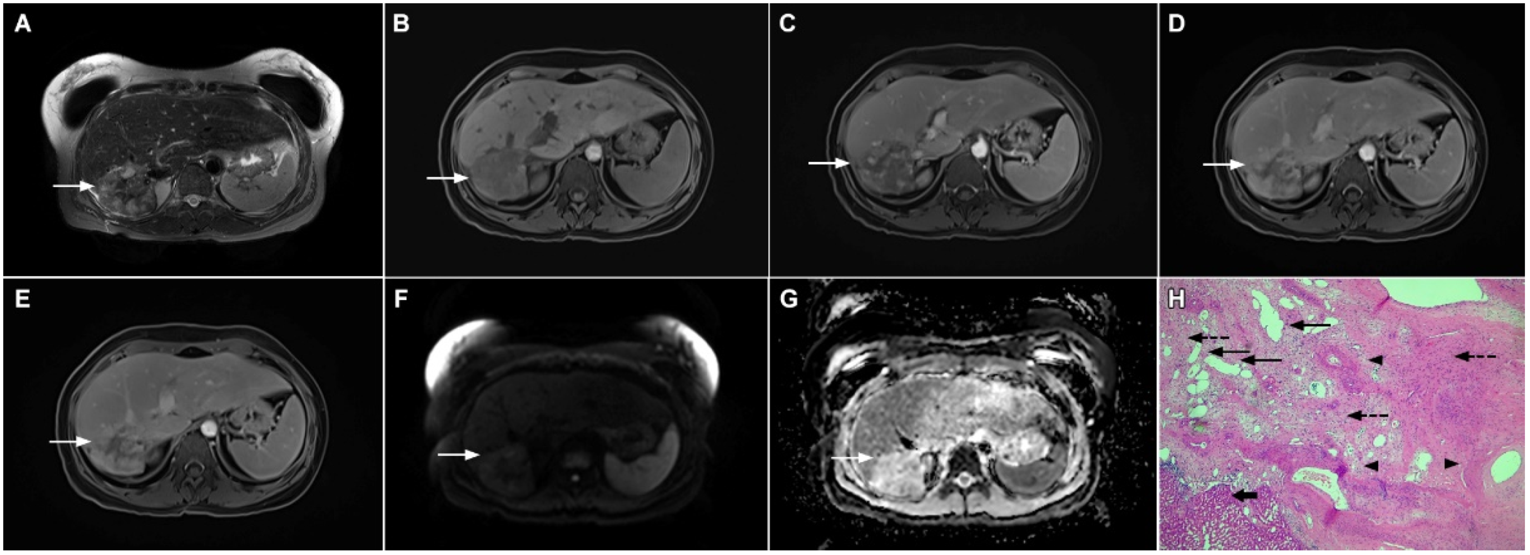 Curroncol 29 00061 g009 Curroncol 29 00061 g009