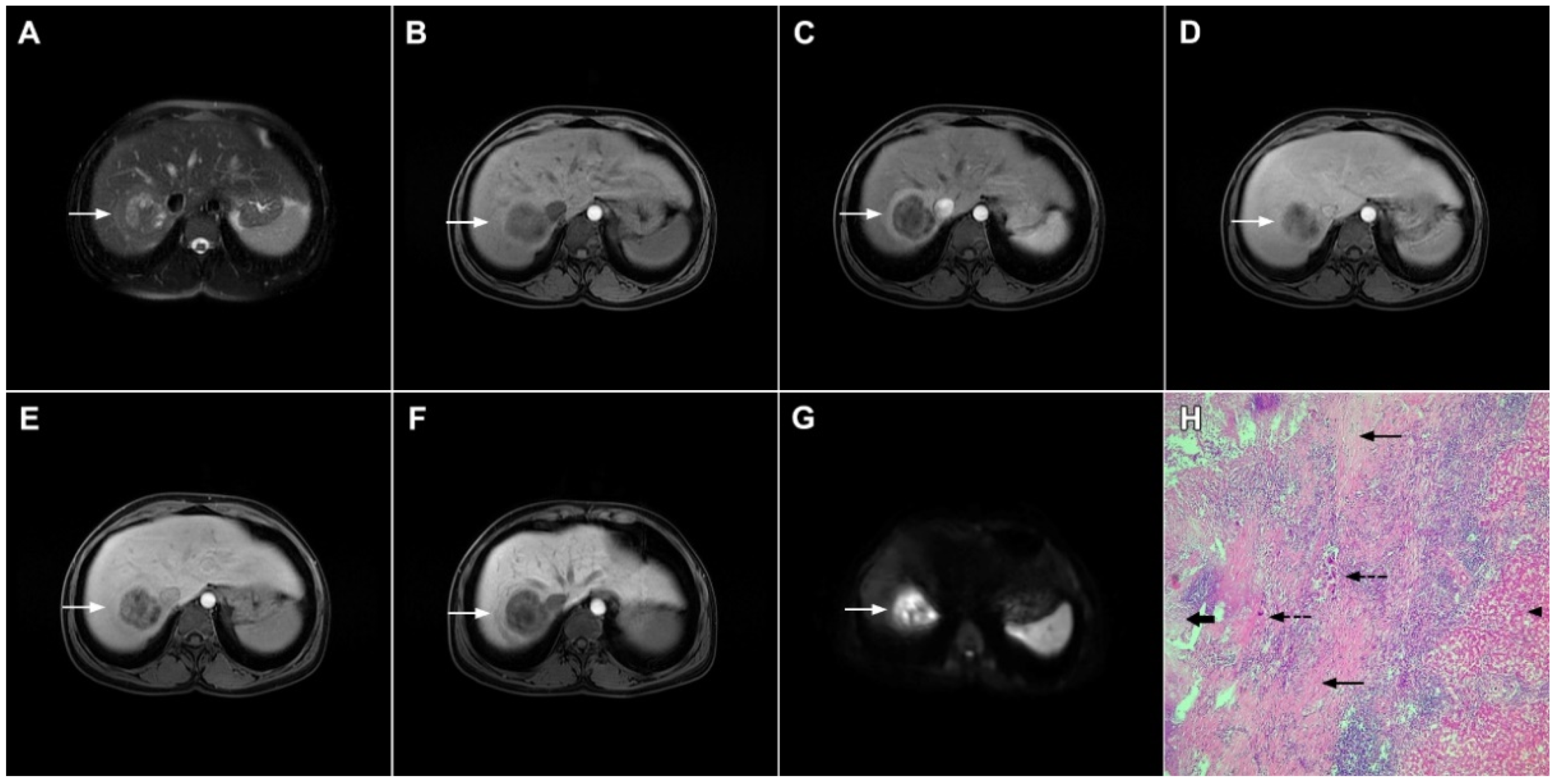 Curroncol 29 00061 g010 Curroncol 29 00061 g010