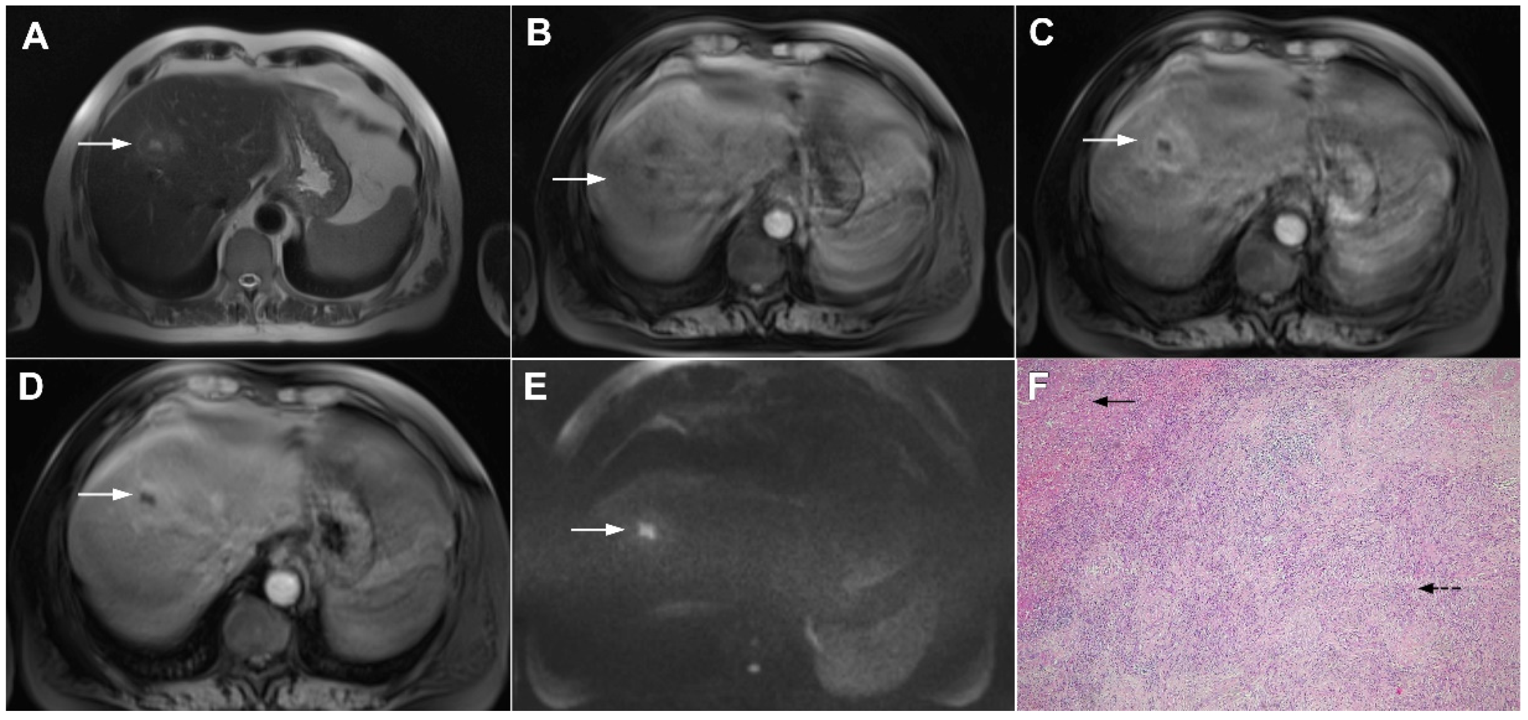 Curroncol 29 00061 g011 Curroncol 29 00061 g011