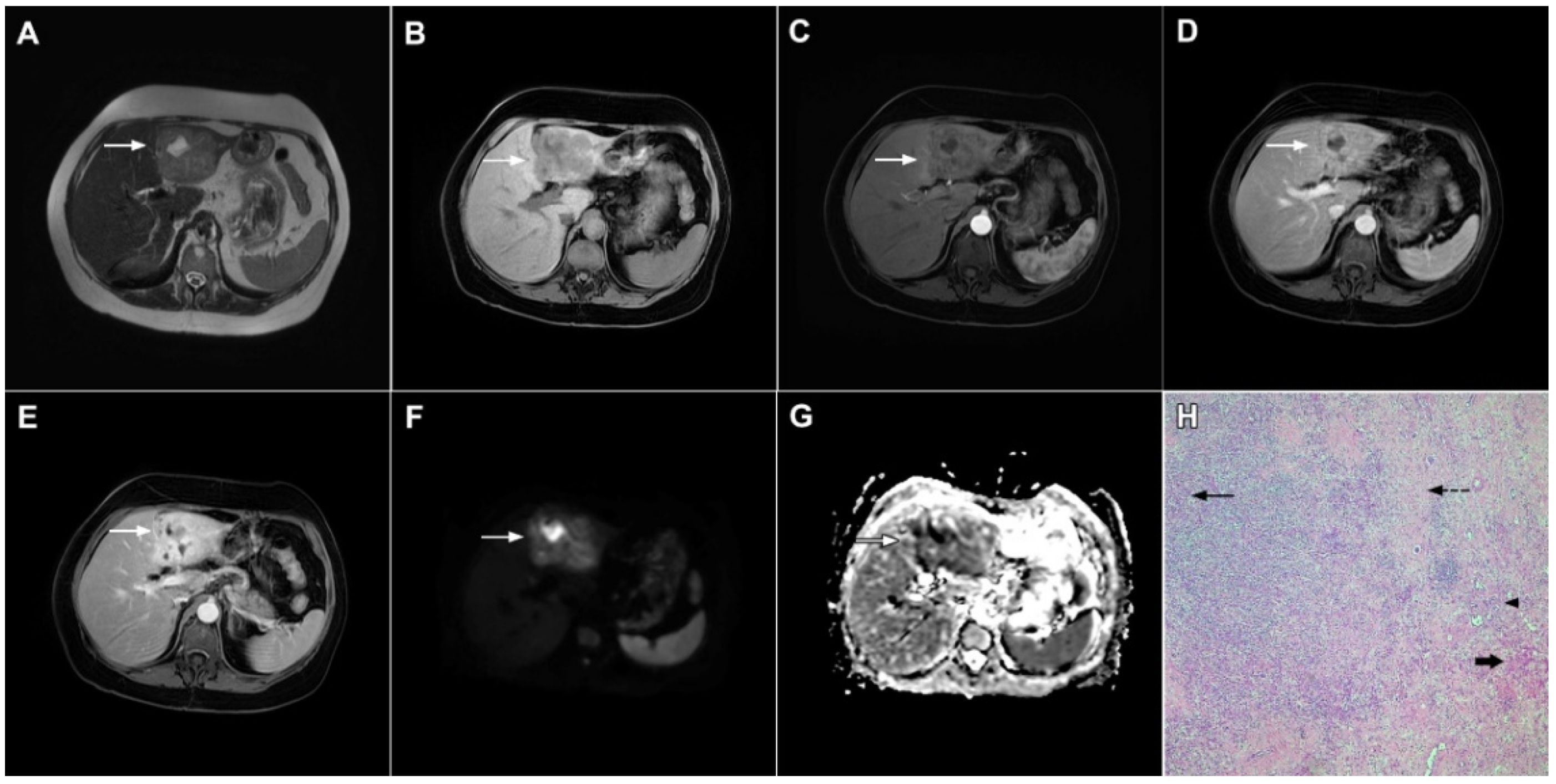 Curroncol 29 00061 g012 Curroncol 29 00061 g012
