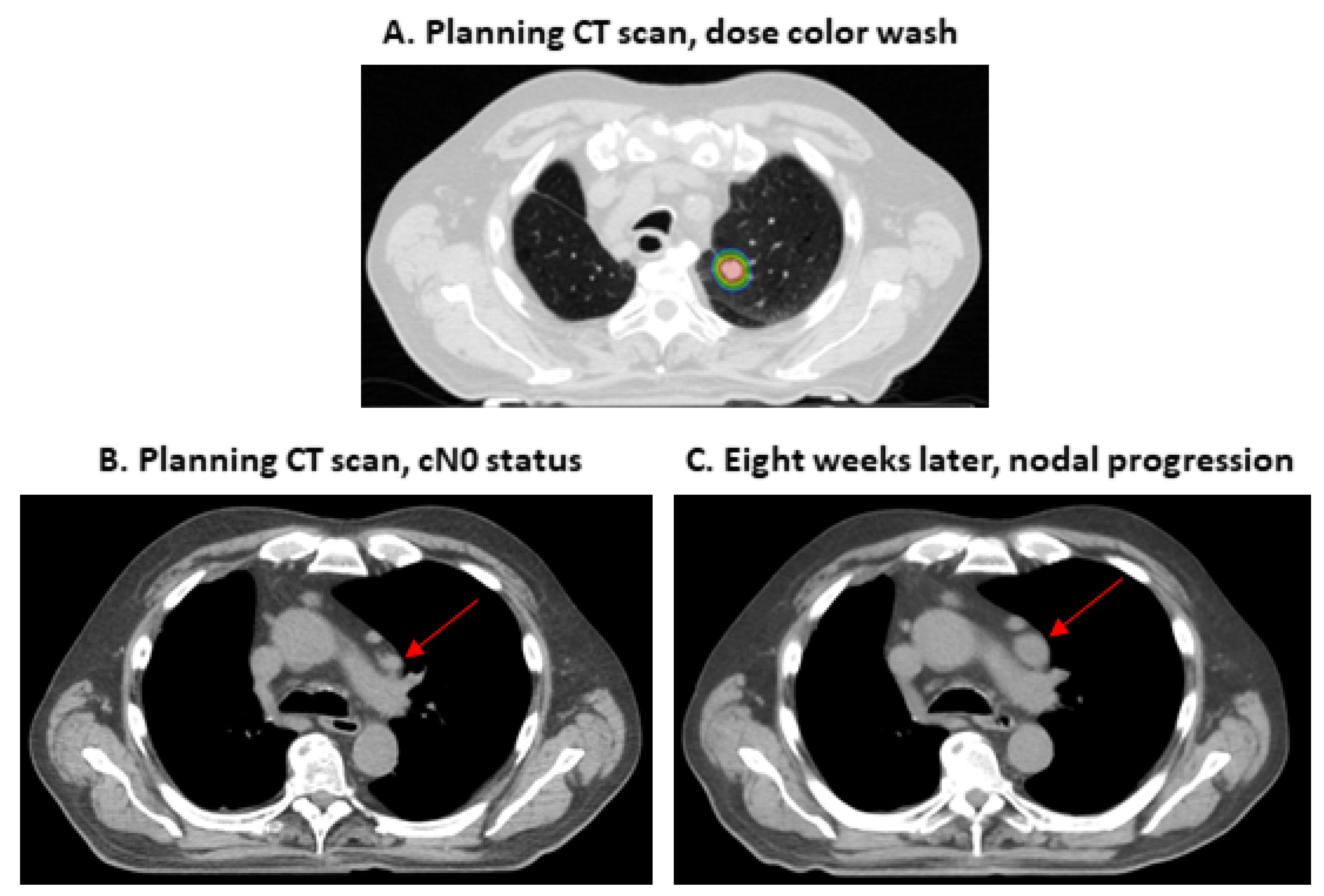 Curroncol 29 00092 g005