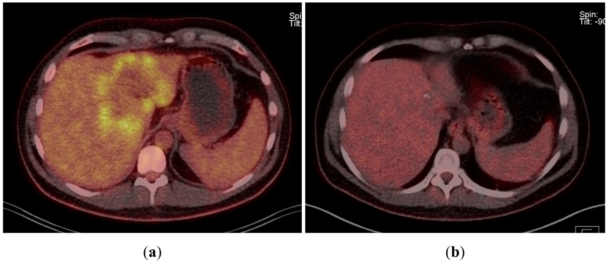 Curroncol 29 00157 g002