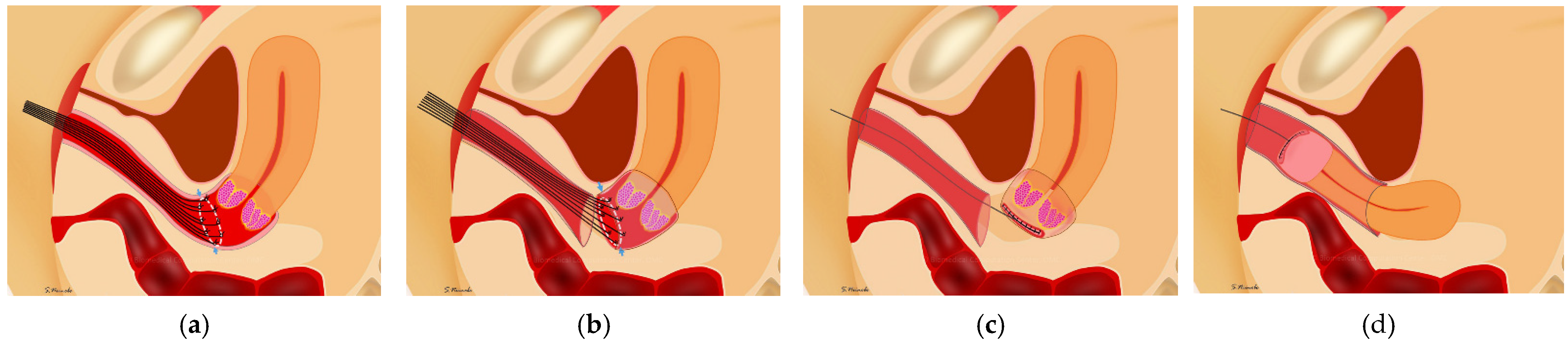 Curroncol 29 00185 g002