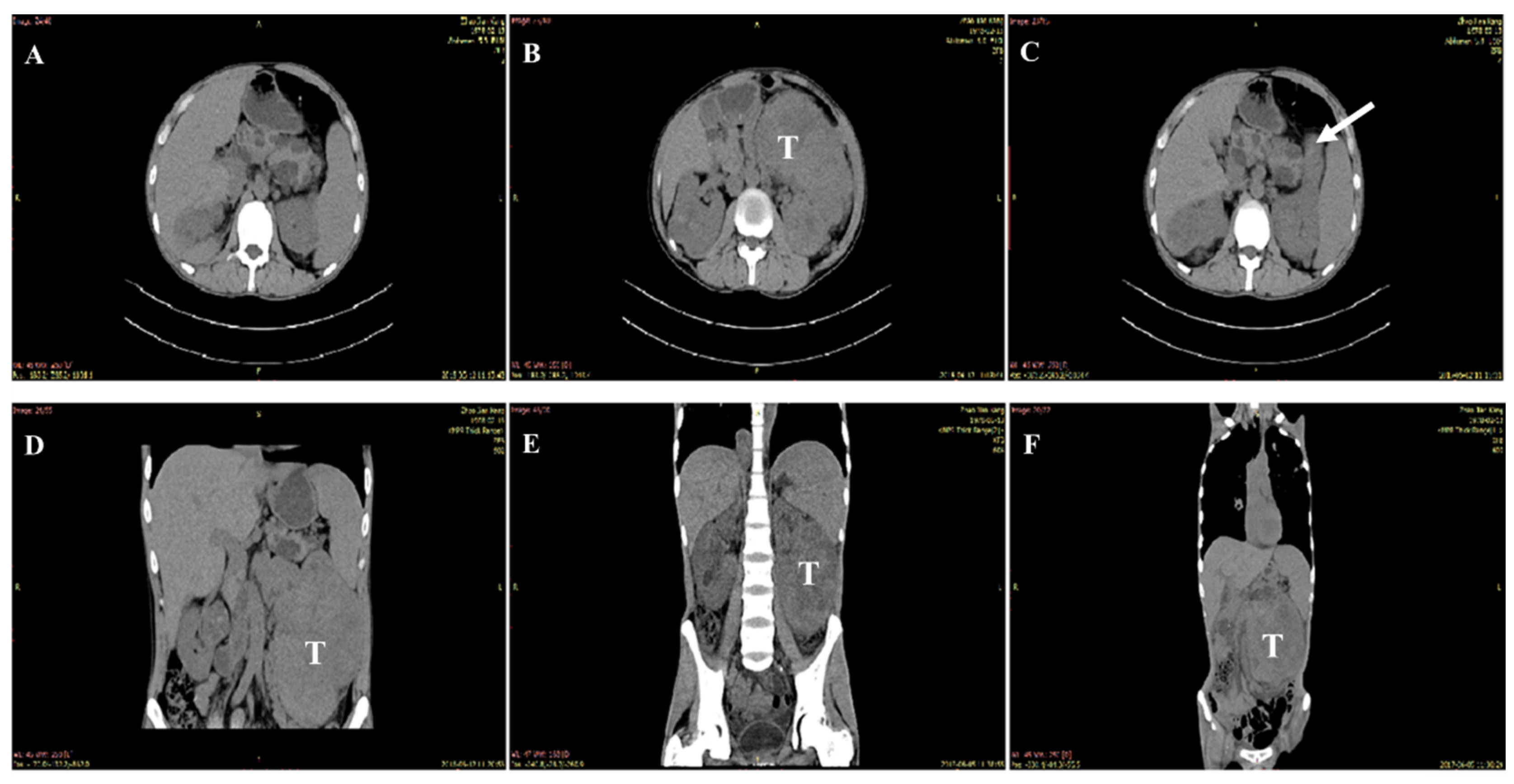 Curroncol 29 00192 g001