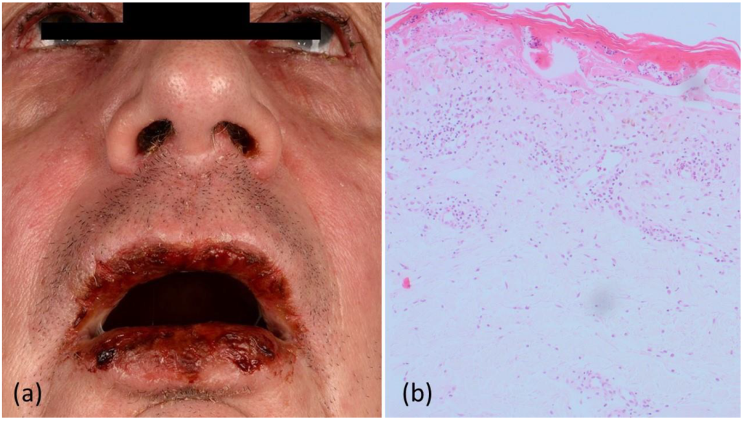 Curroncol 29 00194 g001