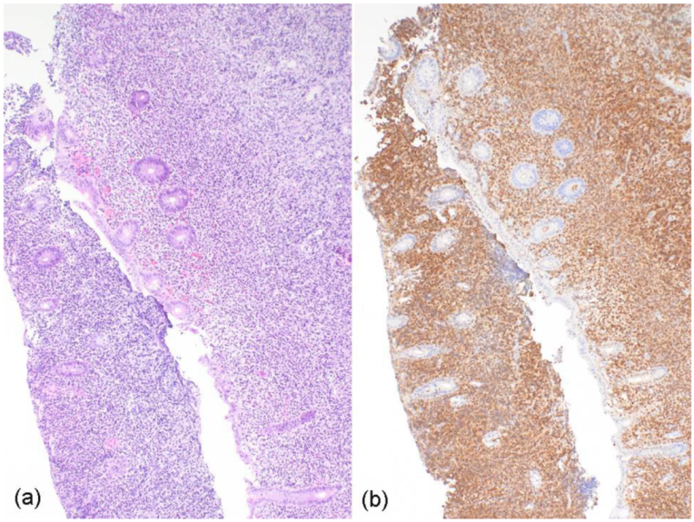 Curroncol 29 00194 g003