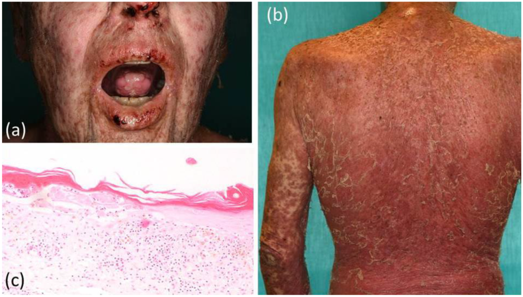 Curroncol 29 00194 g004