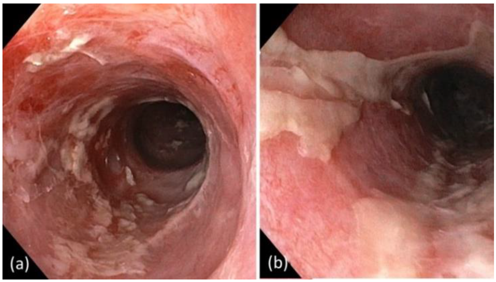 Curroncol 29 00194 g005