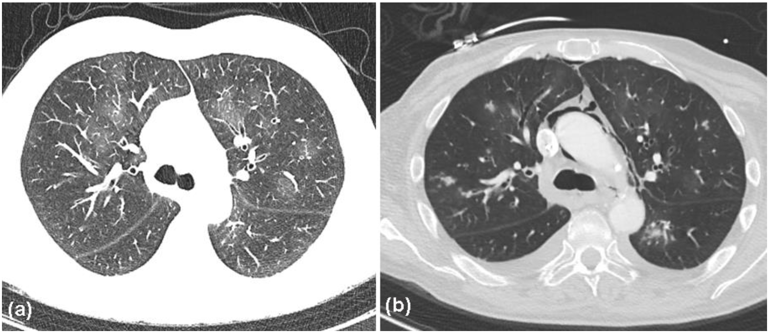 Curroncol 29 00194 g007