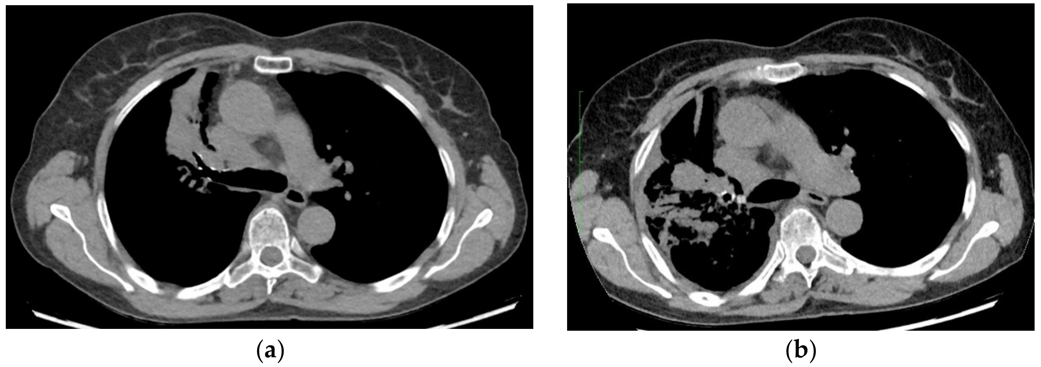 Curroncol 29 00285 g001