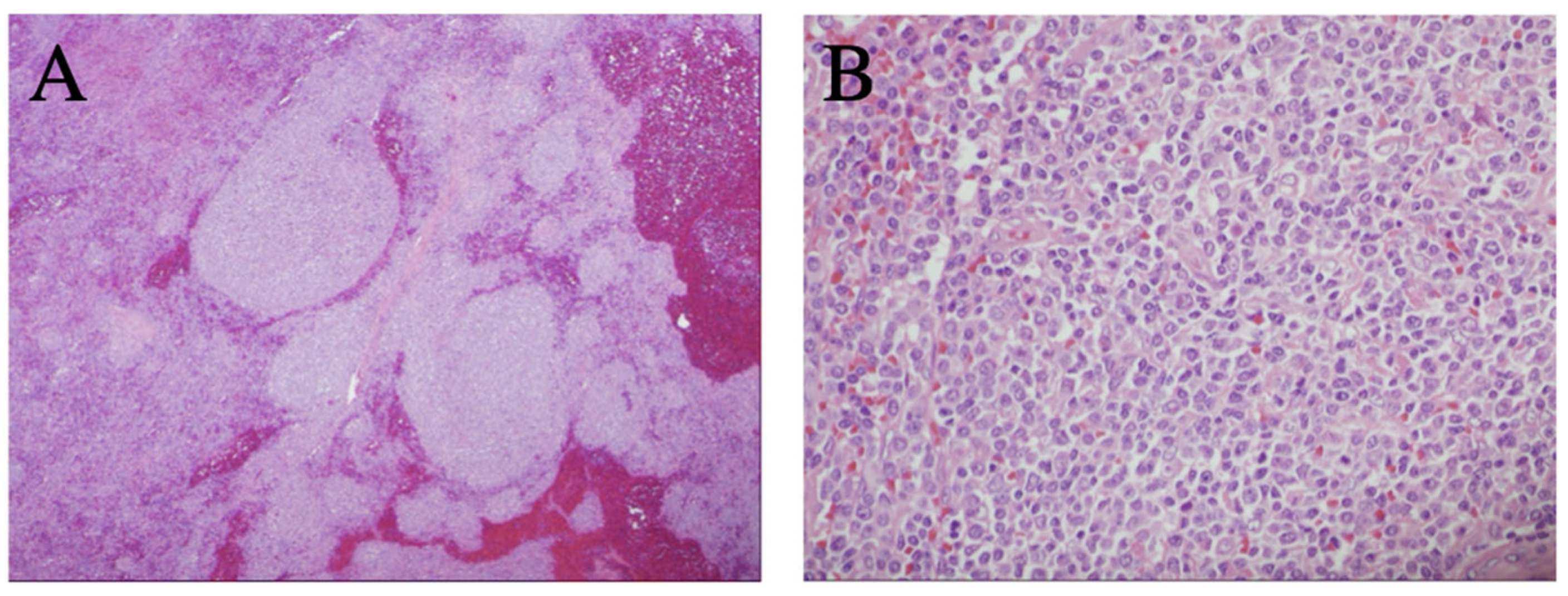 Curroncol 29 00328 g001 Curroncol 29 00328 g001