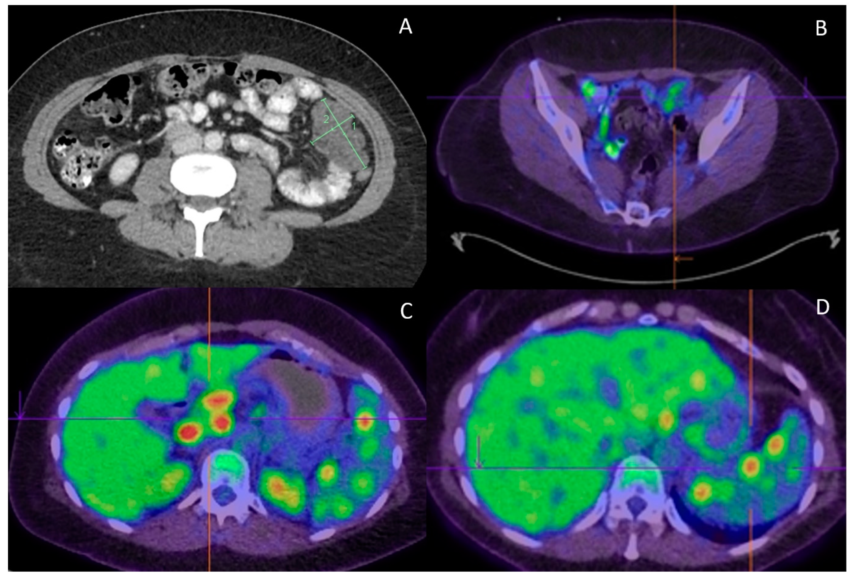 Curroncol 29 00331 g002