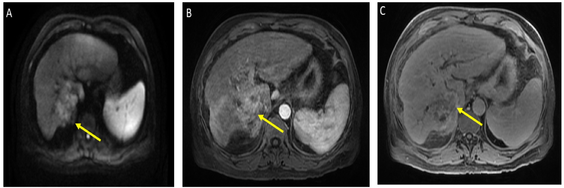 Curroncol 29 00341 g001