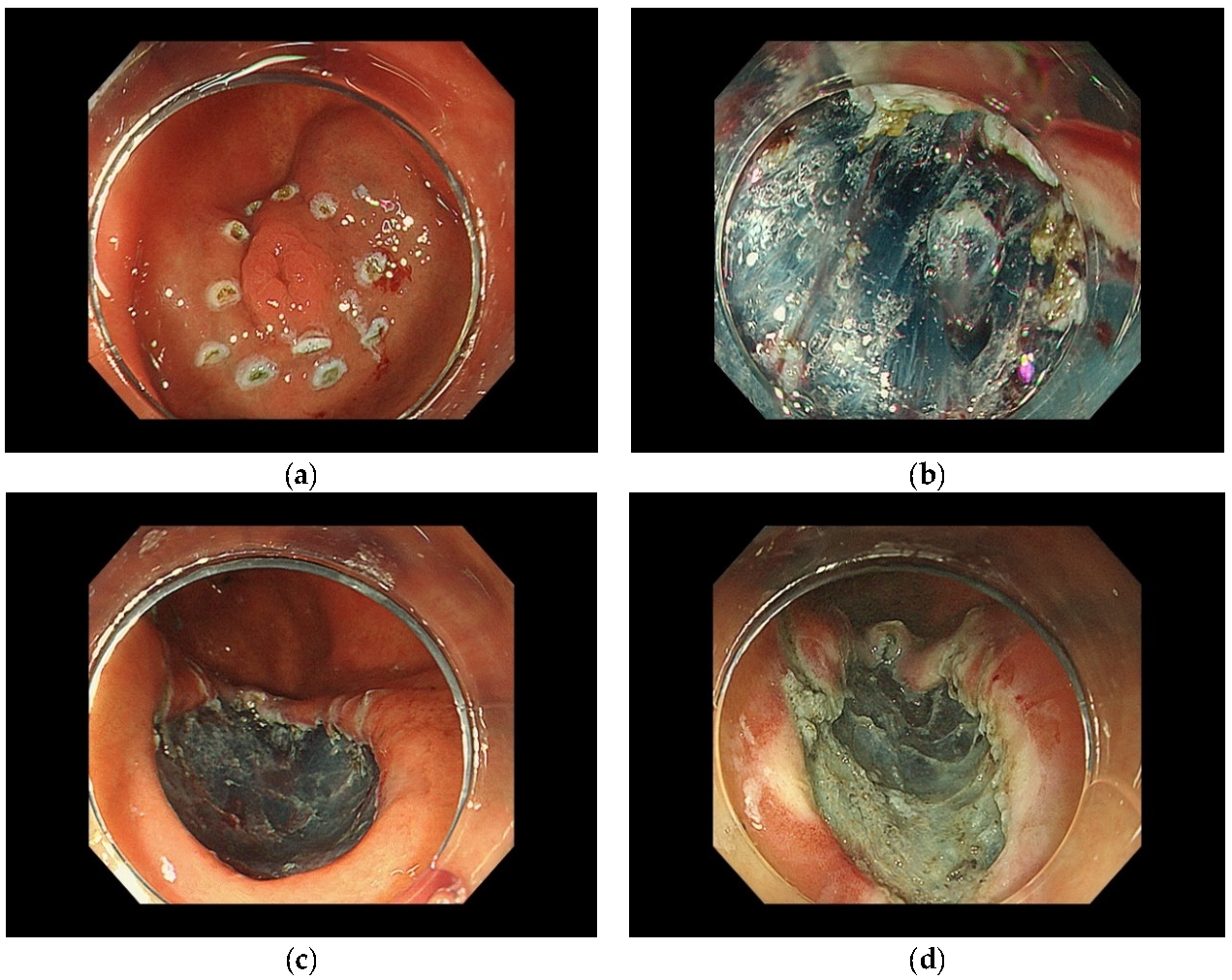 Curroncol 29 00371 g001