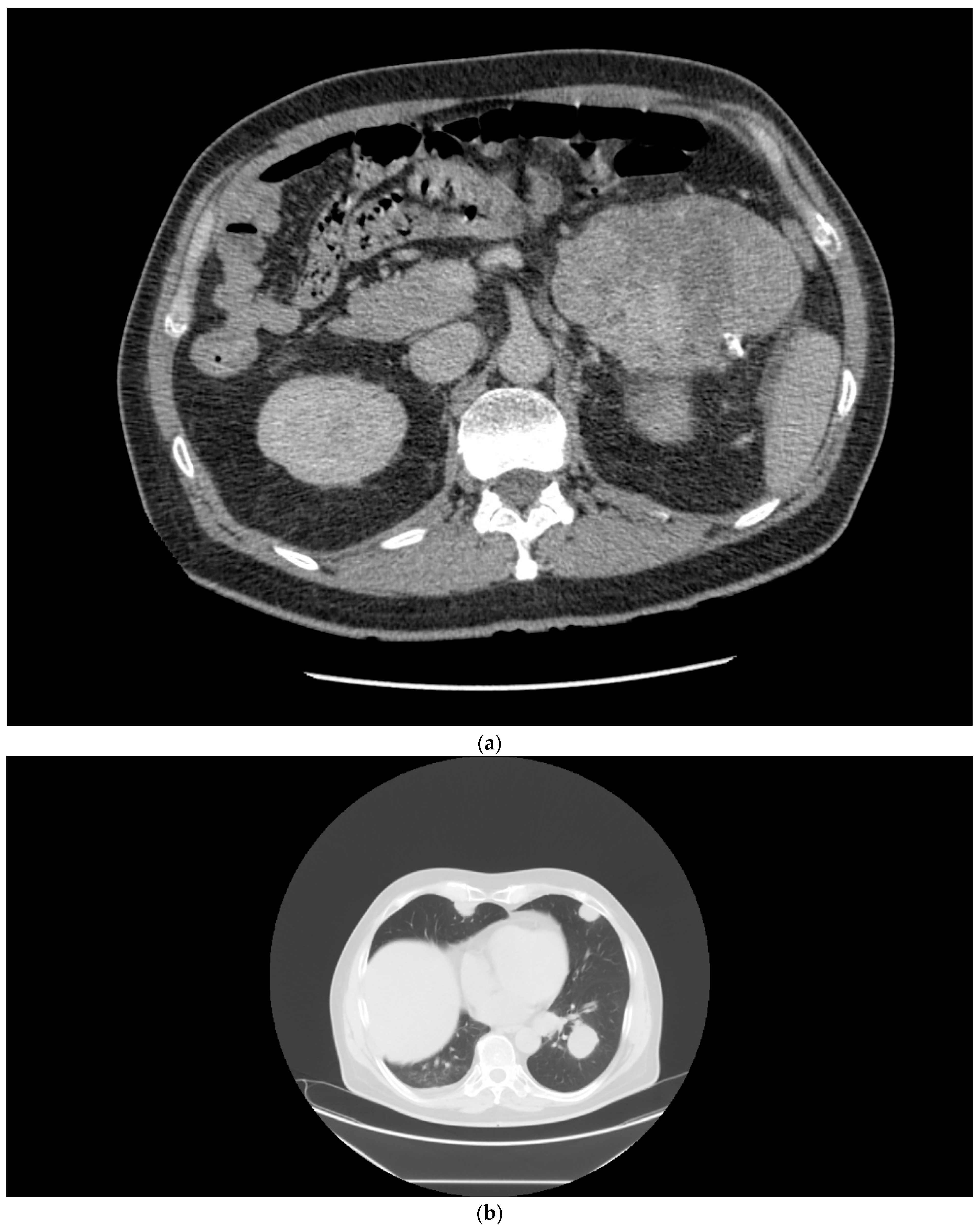 Curroncol 29 00433 g002a