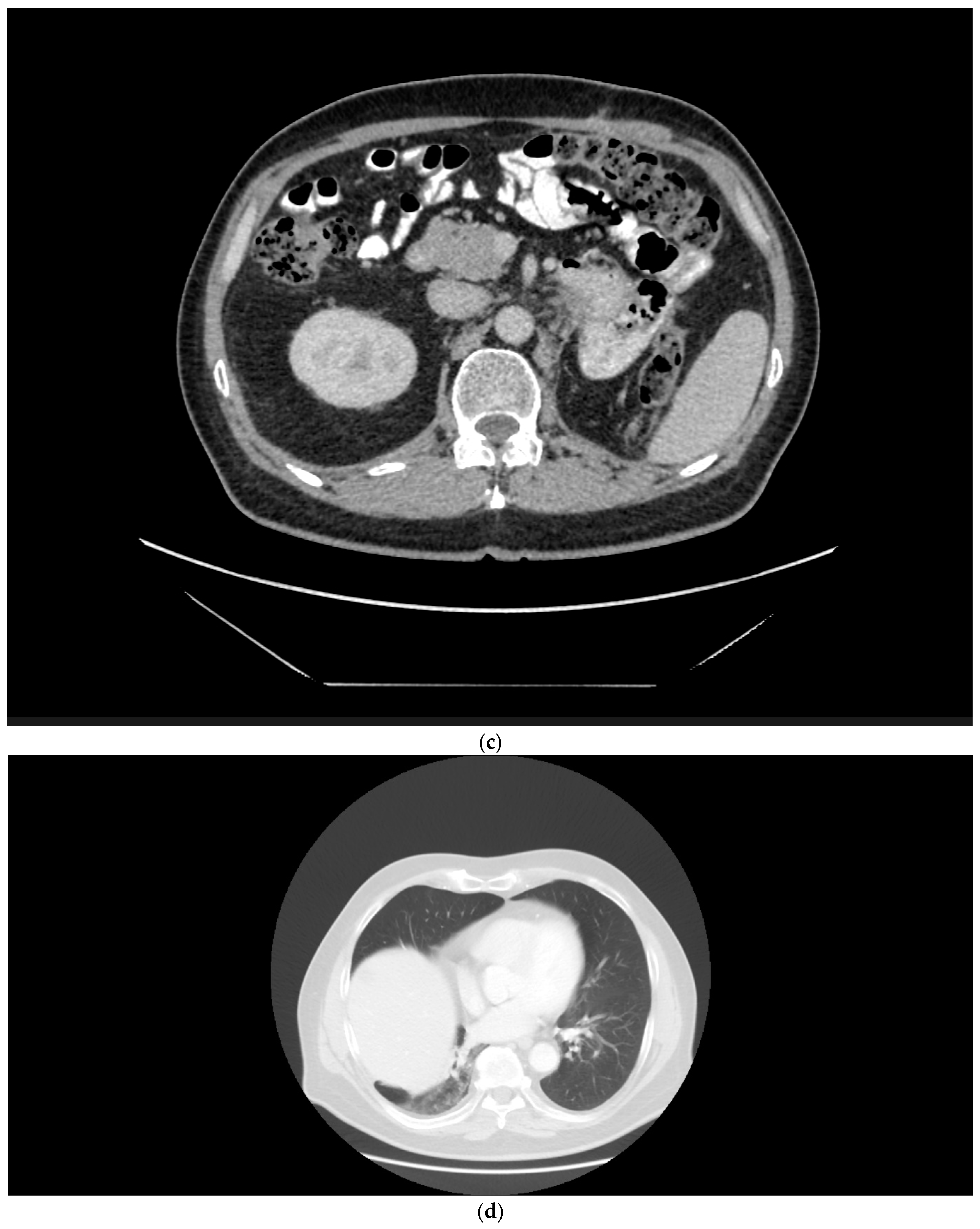 Curroncol 29 00433 g002b