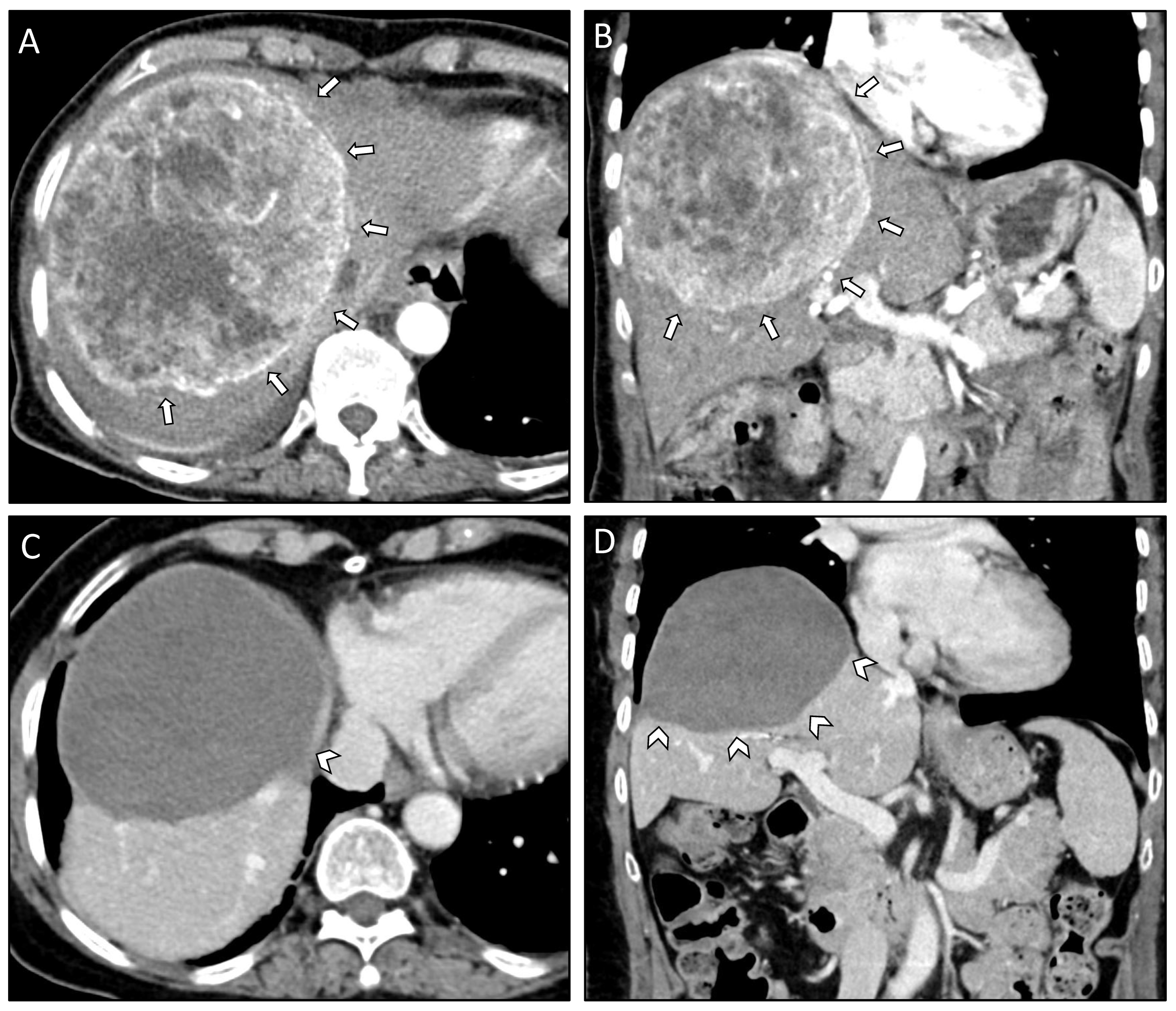 Curroncol 29 00687 g001