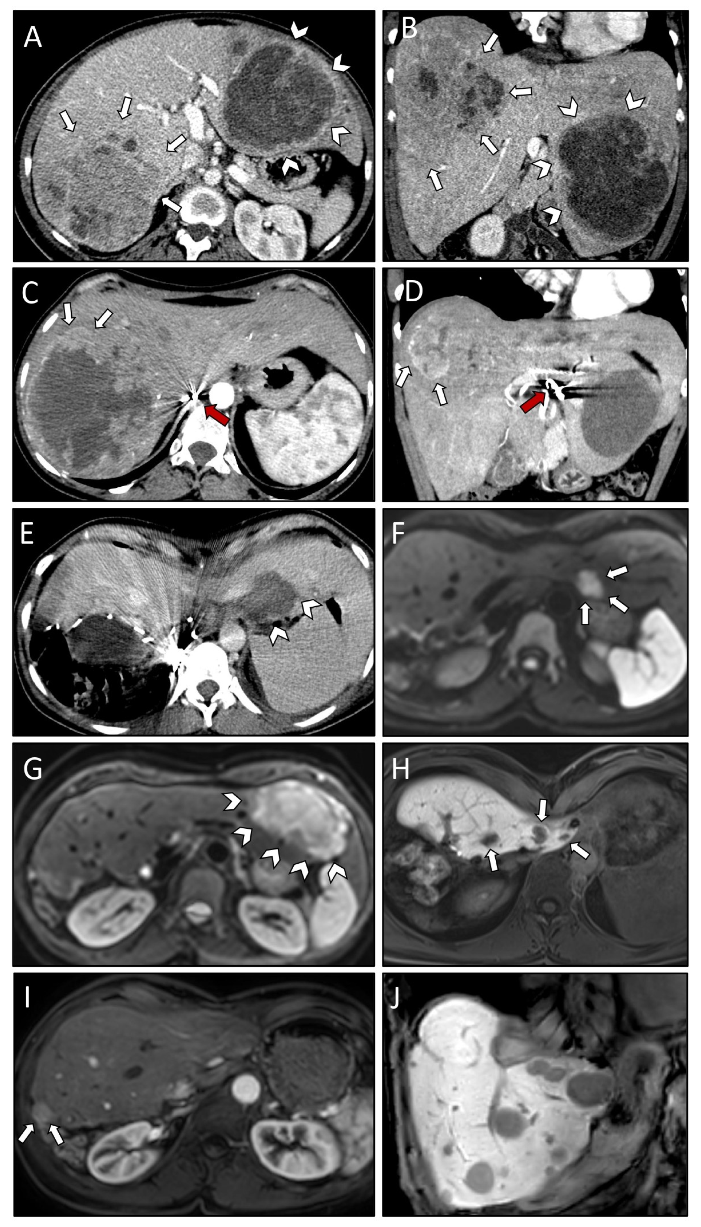 Curroncol 29 00687 g002