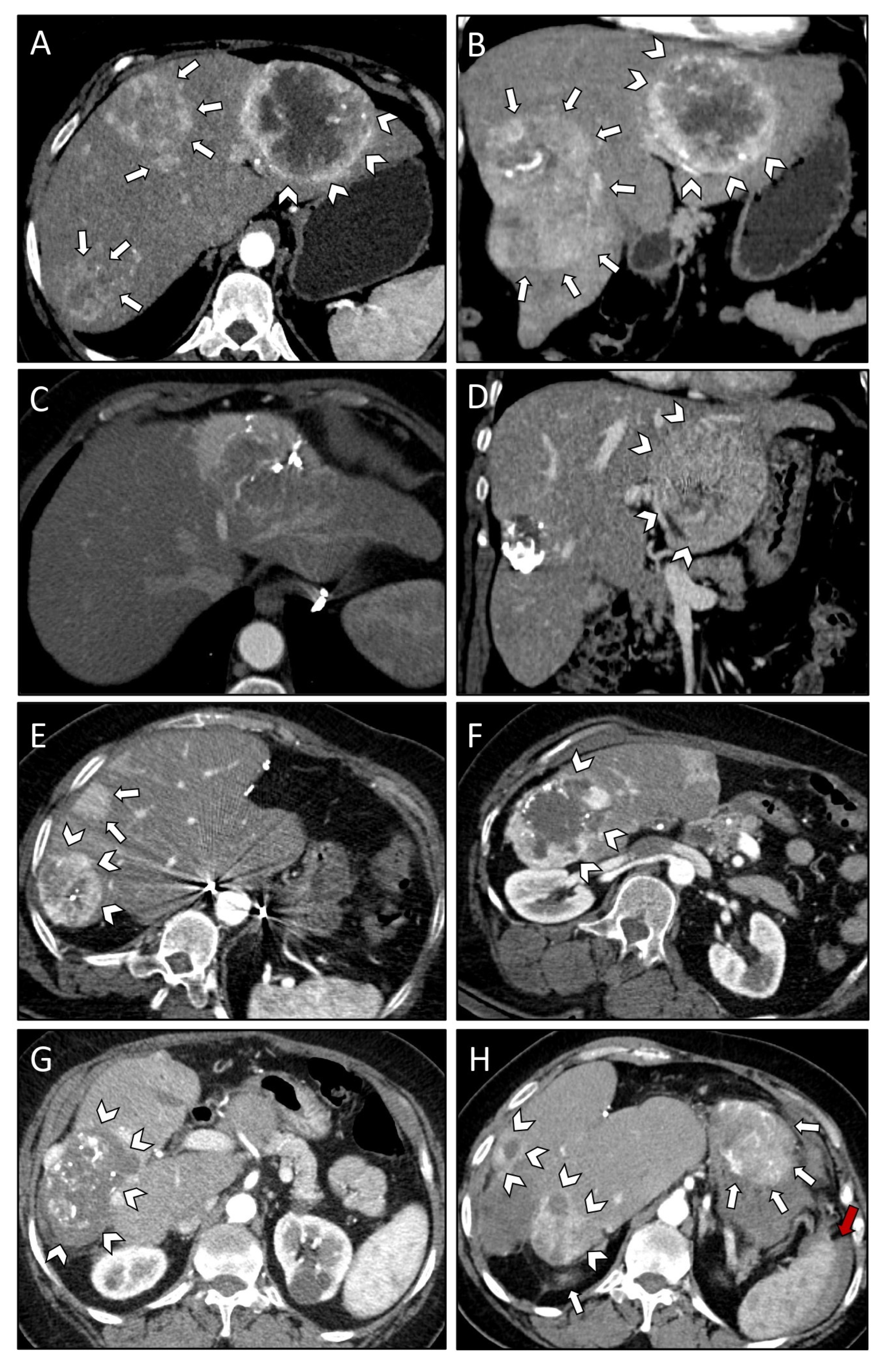 Curroncol 29 00687 g003