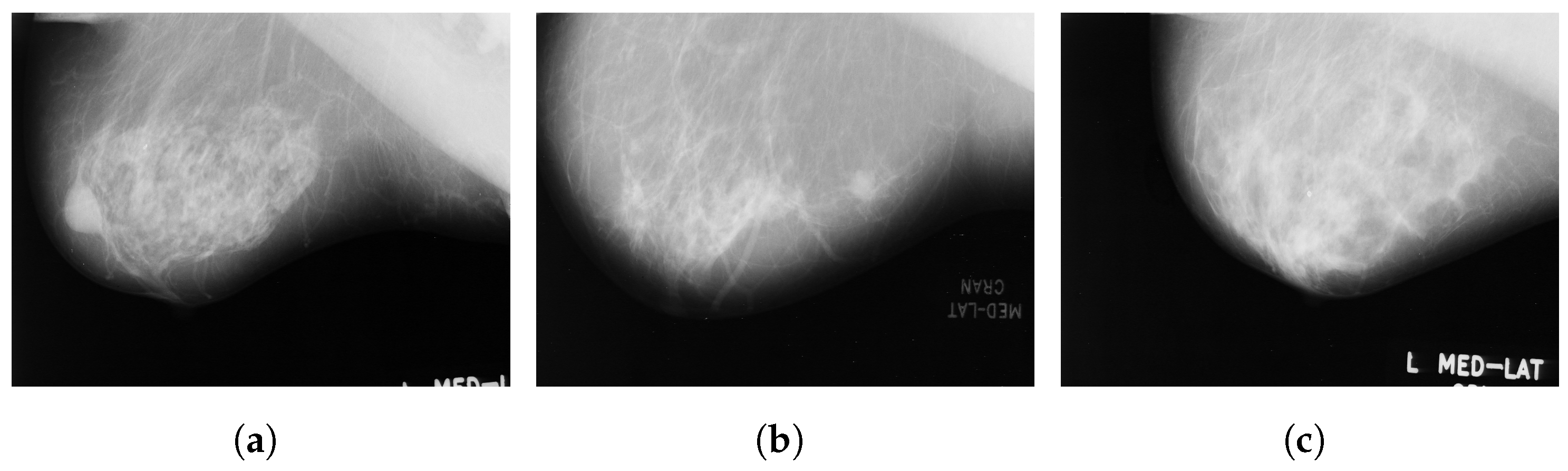 Curroncol 29 00690 g002