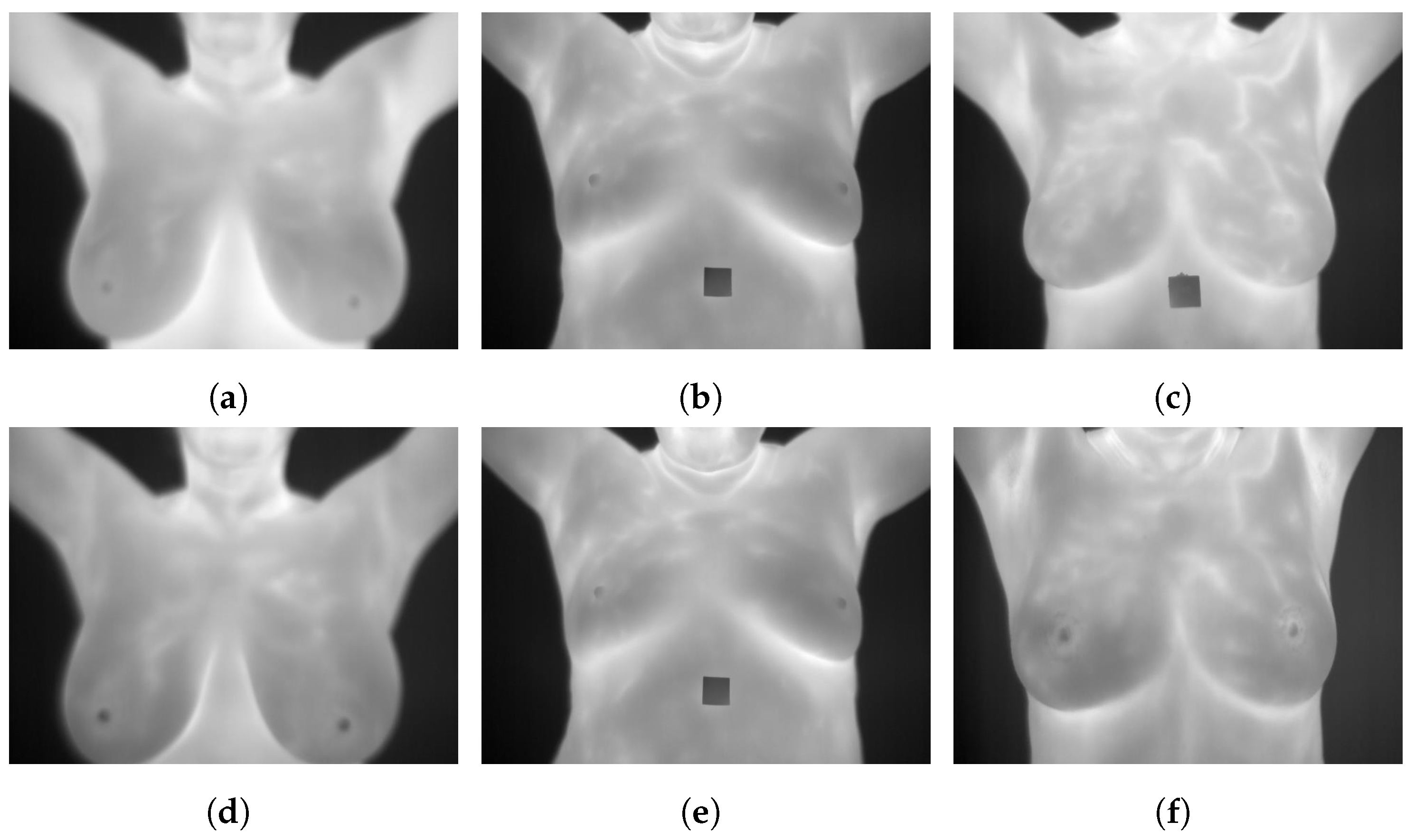 Curroncol 29 00690 g004