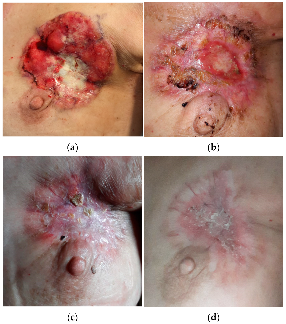 Curroncol 29 00756 g001a