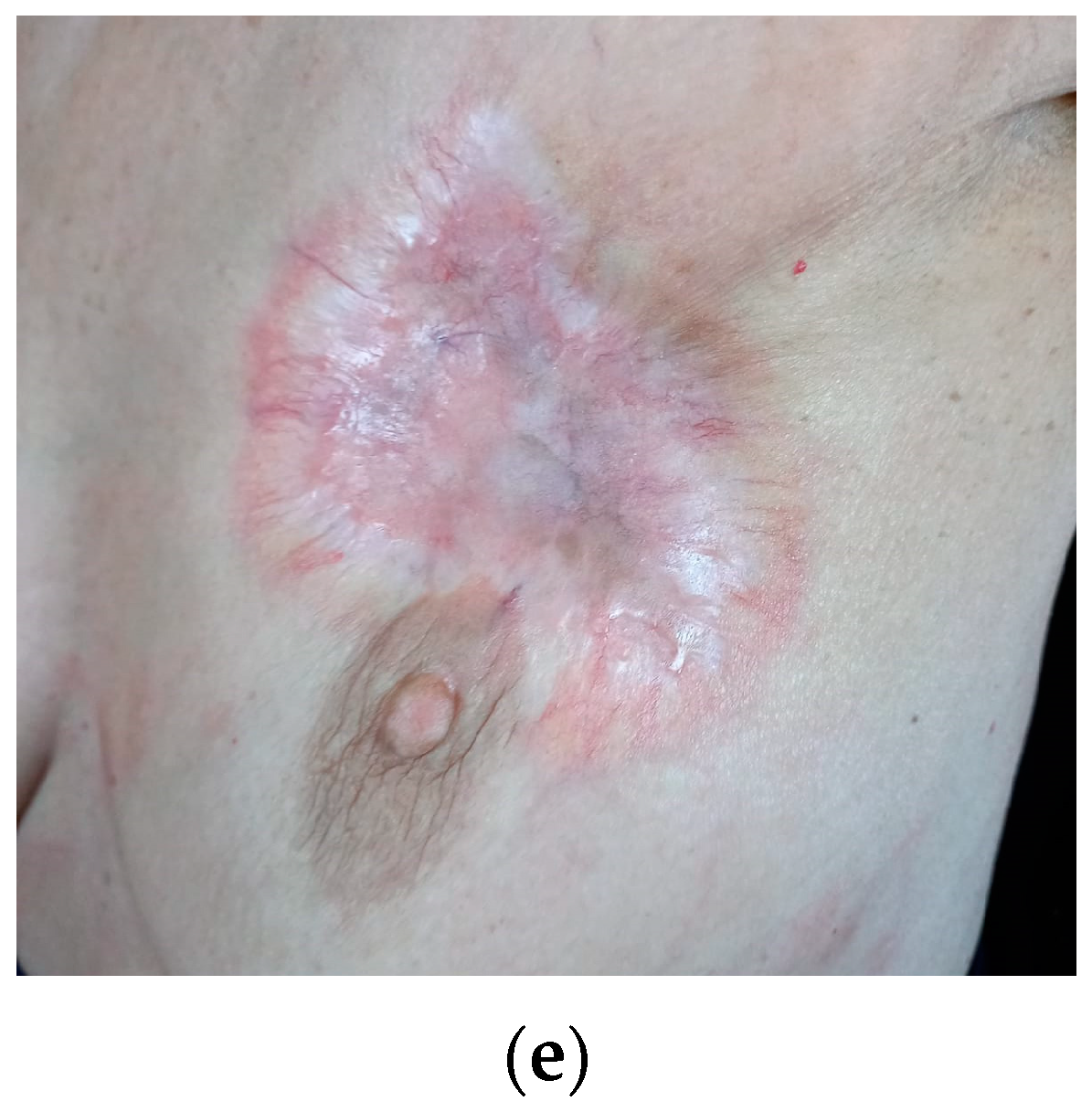 Curroncol 29 00756 g001b