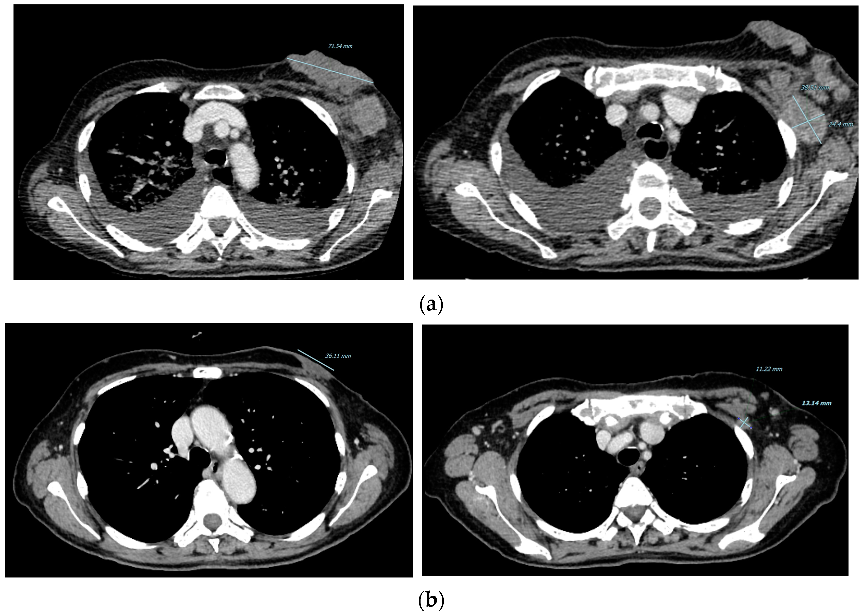 Curroncol 29 00756 g002
