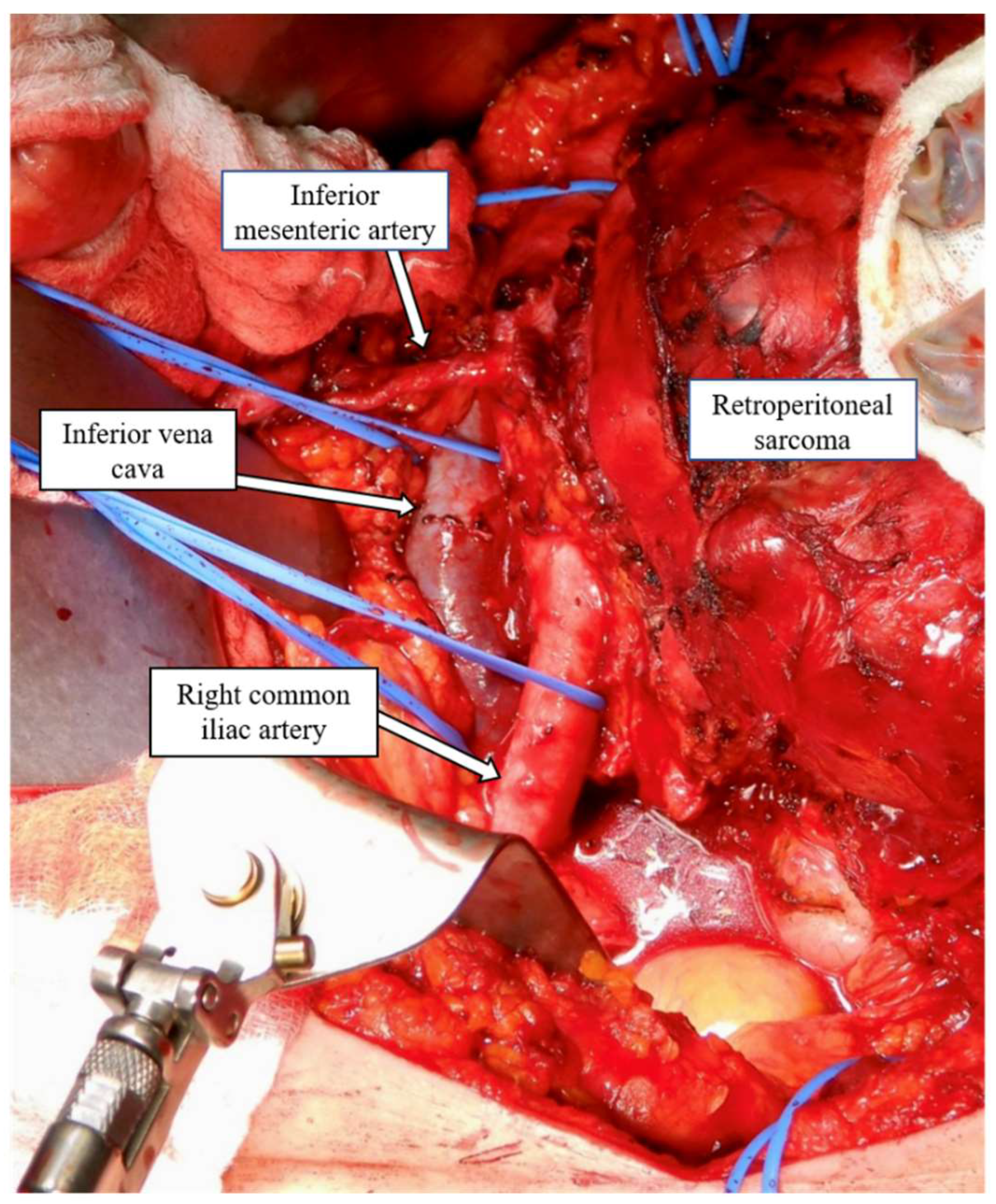 Curroncol 30 00039 g002