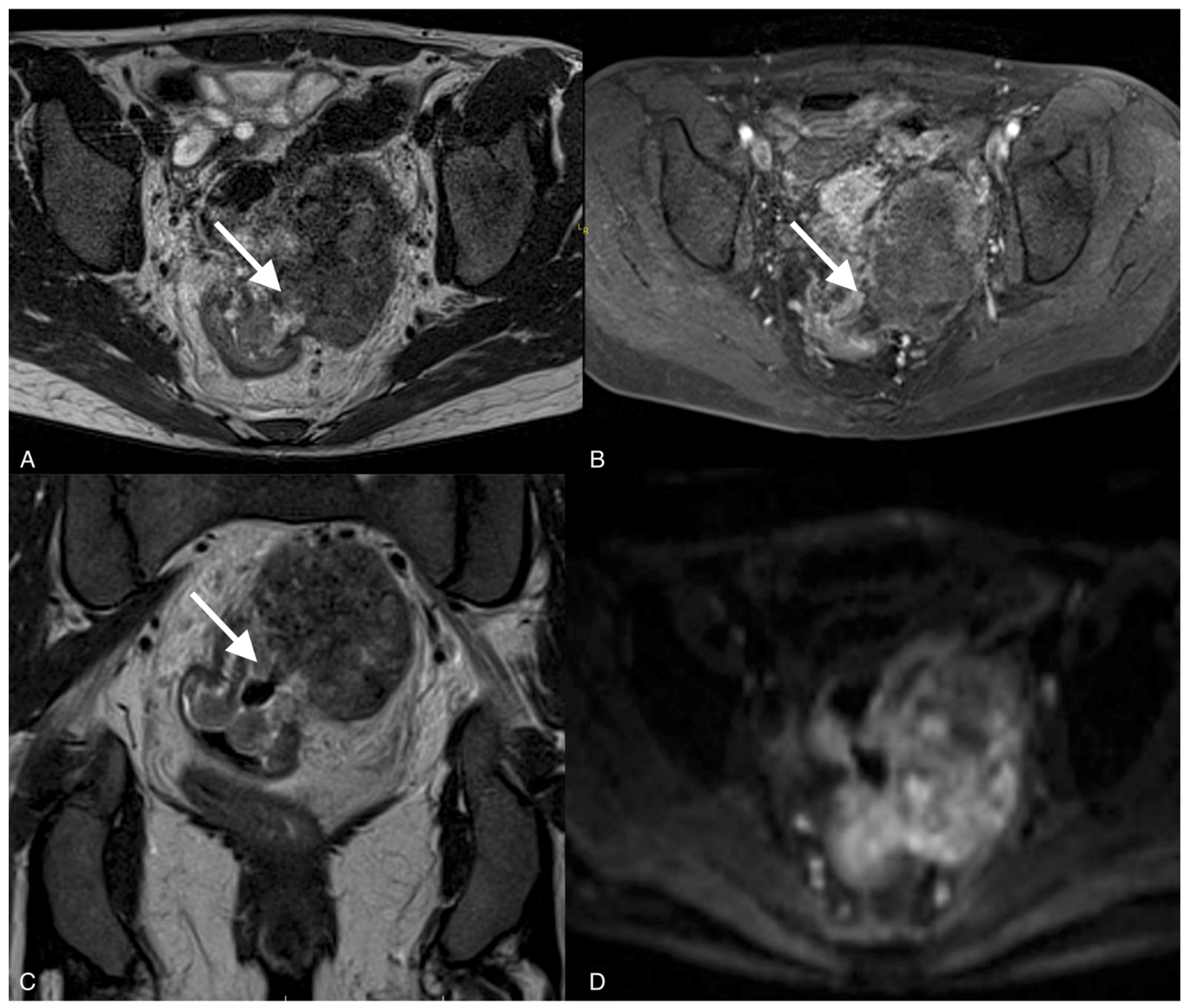 Curroncol 30 00040 g004