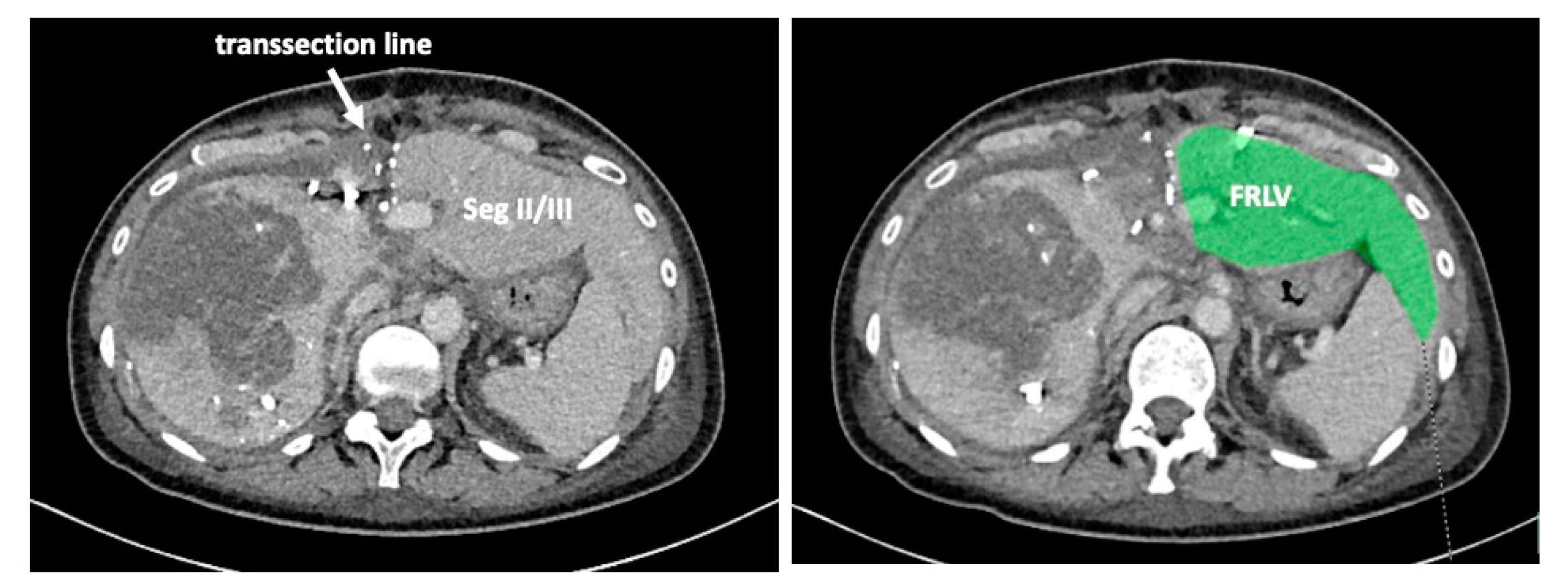 Curroncol 30 00249 g006