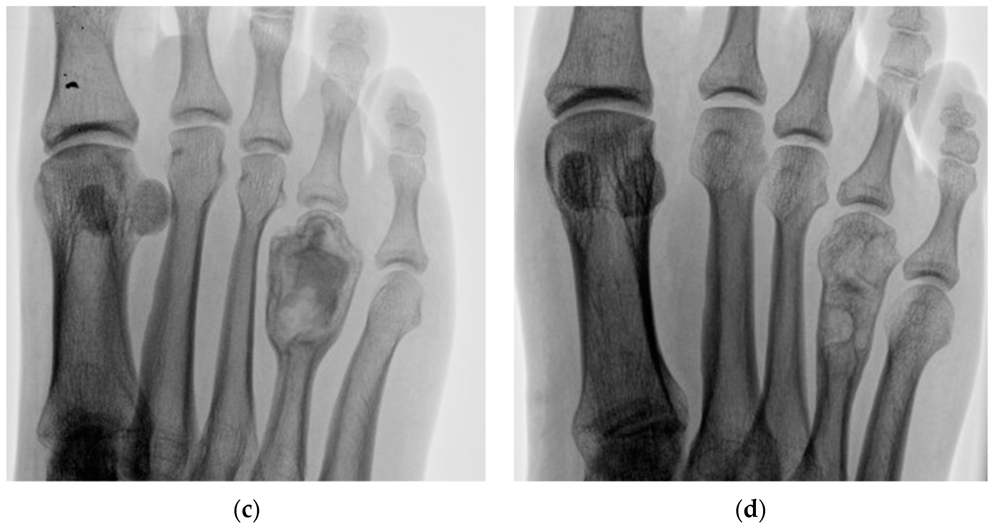 Curroncol 30 00281 g001b