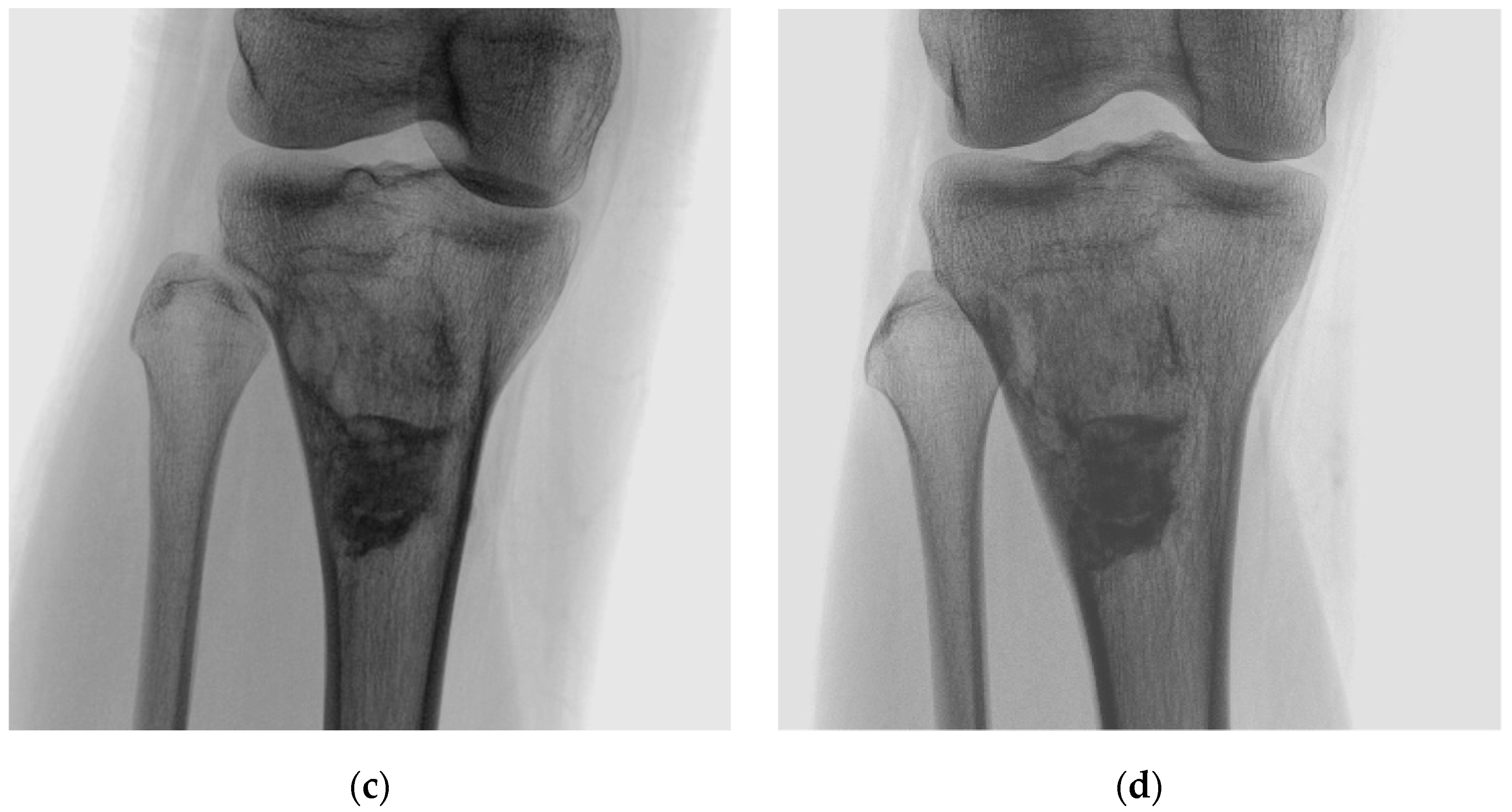 Curroncol 30 00281 g002b