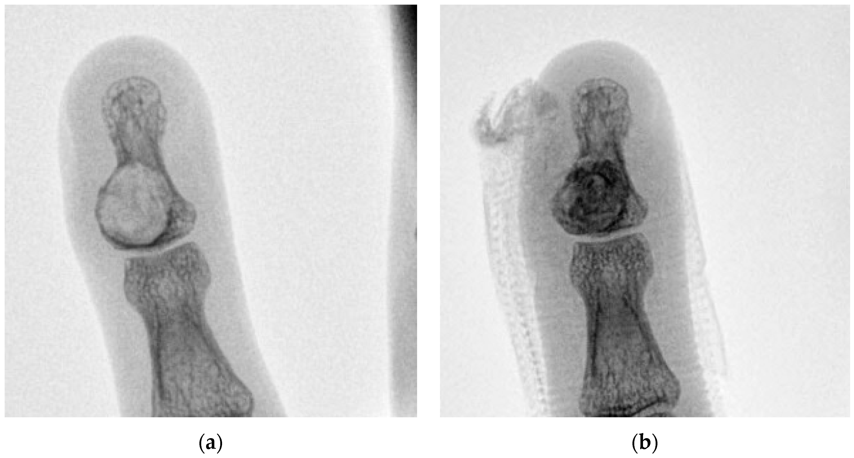 Curroncol 30 00281 g003a