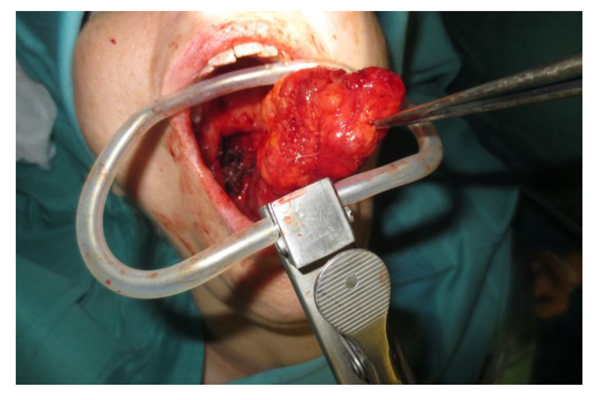 Curroncol 30 00297 g003 Curroncol 30 00297 g003