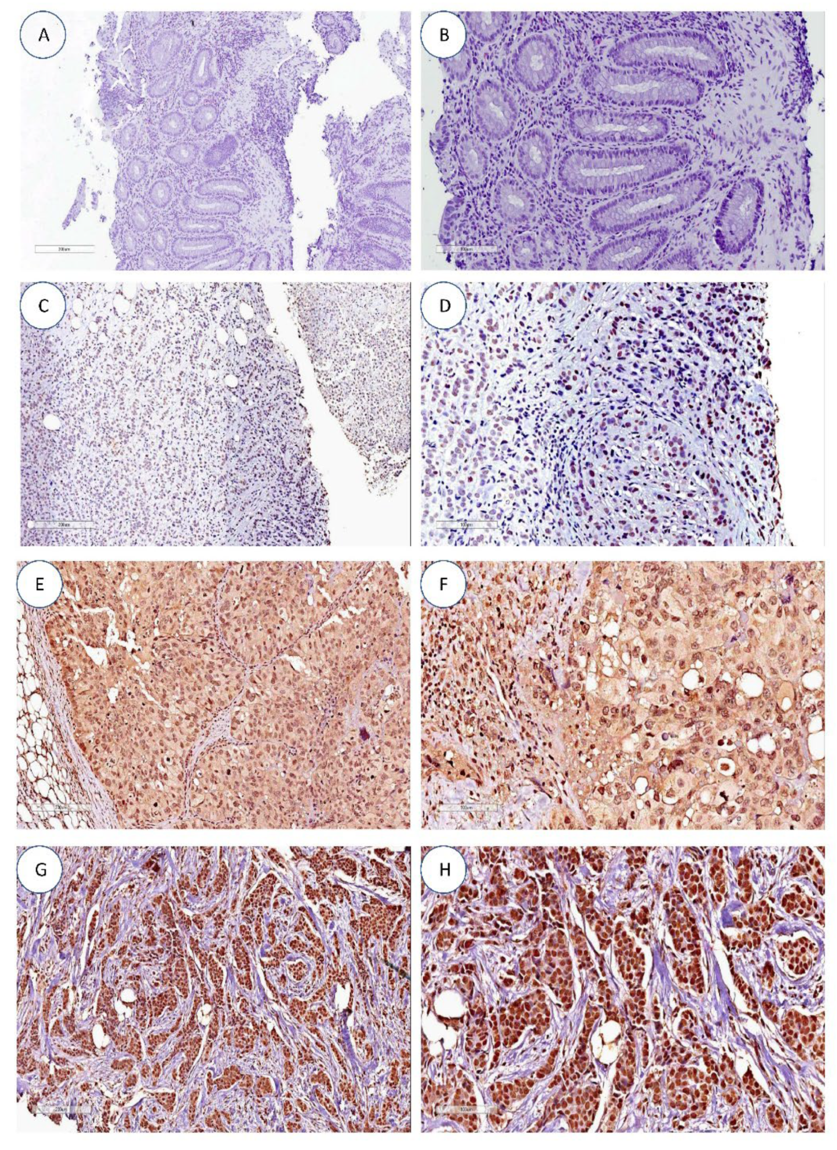 Curroncol 30 00311 g001 Curroncol 30 00311 g001