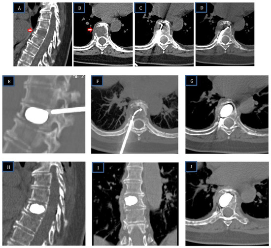 Curroncol 30 00324 g002